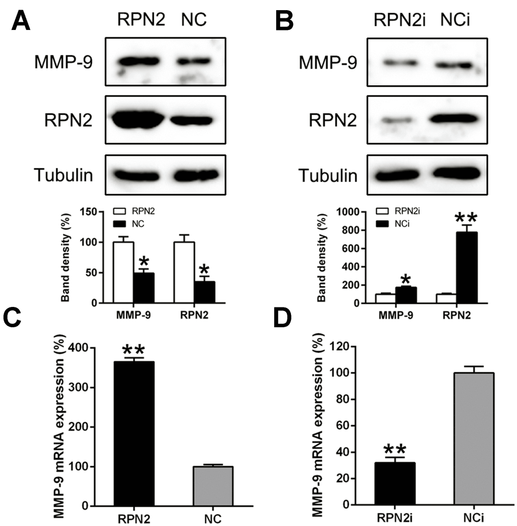 RPN2 Promotes Metastasis Of Hepatocellular Carcinoma Cell And Inhibits 