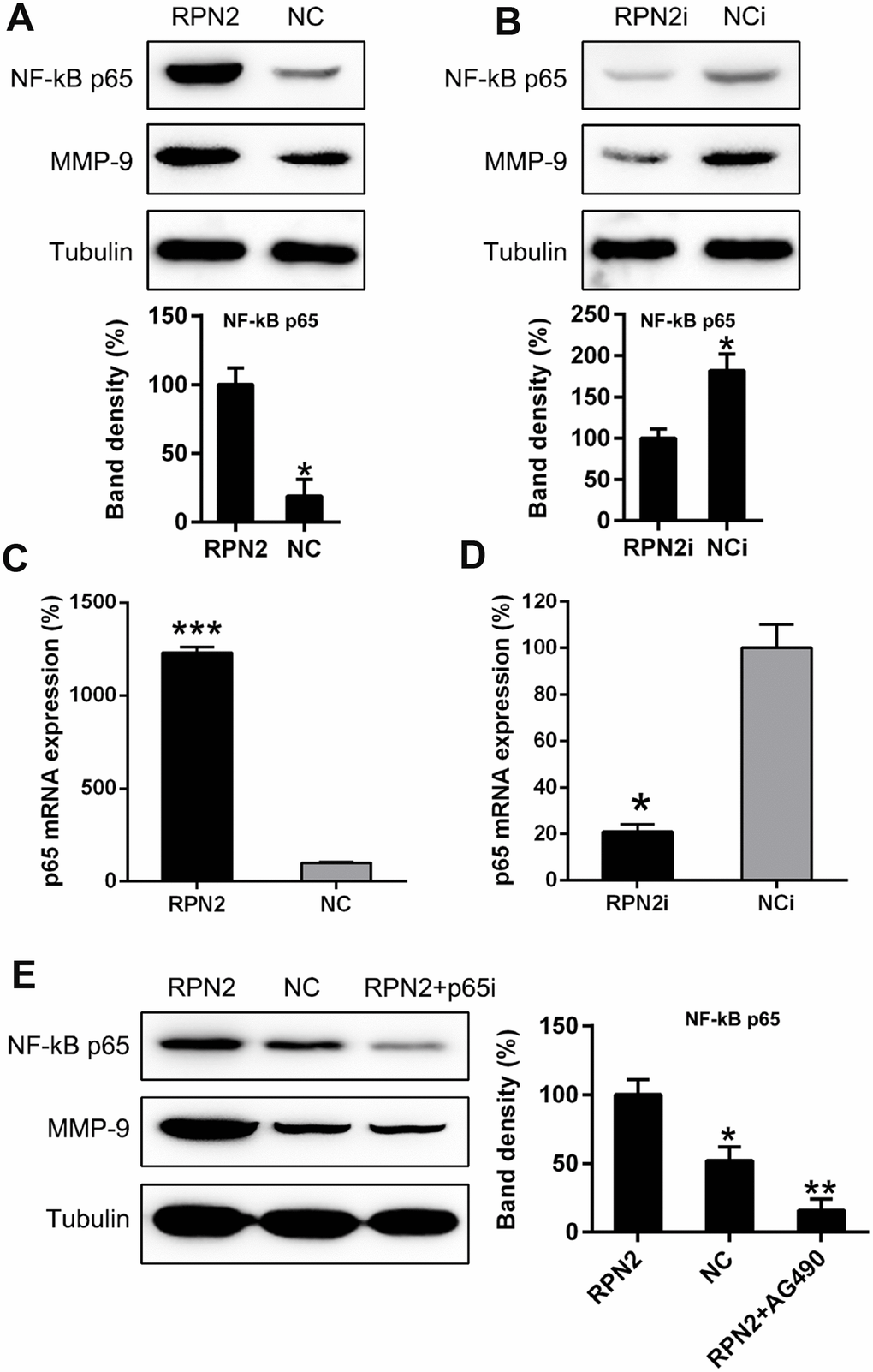 NF-κB is partially responsible for RPN2-mediated MMP-9 expressive level in HepG2 cells. (A, B) HepG2 cells were transfected with AD-RPN2 or shRNA-RPN2 to modulate the RPN2 level, WB assay was conducted to examine the MMP-9 as well as NF-κB protein expression. (C, D) mRNA expression of MMP-9 and NF-κB p65 was then analyzed by qPCR. (E) HepG2 cells stably expressing RPN2 were transfected with shRNA-p65 to silencing the p65 expression. Protein expression of MMP-9 and p65 were then determined via WB. The band of target protein was normalized to the density of action. The quantification was performed independently in a single band. The experiments were performed three times. Data are represented as mean ± SD. *P P 