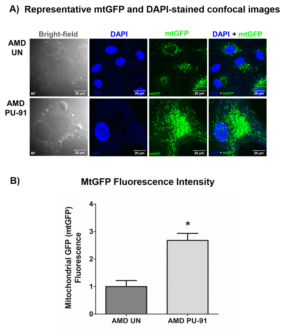 PU-91 alters mitochondrial GFP fluorescence intensity. Untreated (AMD UN) and PU-91-treated AMD cybrids (AMD PU-91) were stained with CellLight mitochondrial GFP stain followed by confocal imaging of cells. (A) Shows representative bright-field, DAPI, mtGFP, and overlay (DAPI + mtGFP) confocal images. PU-91-treated AMD cybrids had a drastic increase in mtGFP fluorescence intensity compared to the untreated group (p≤0.05, n=3) (B). Data are presented as mean ±SEM and normalized to untreated (UN) AMD cybrids which were assigned a value of 1. Mann-Whitney test was used to measure statistical differences; *p≤0.05.