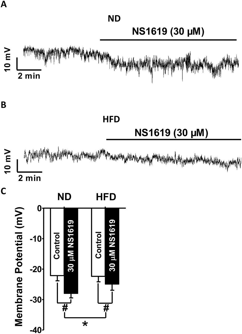 Hyperpolarization of the membrane potential upon pharmacological activation of BK channels is attenuated in HFD DSM cells. Representative recordings in current-clamp mode illustrating the NS1619 (30 μM)-induced hyperpolarization effect on the membrane potential in ND (A) and HFD (B) DSM cells. (C) Summary data indicating a significantly attenuated hyperpolarization effect on the membrane potential in HFD DSM cells compared with ND DSM cells. Data are expressed as the mean ± SEM; n = 8, N = 6 per group; * P NS: not significant.