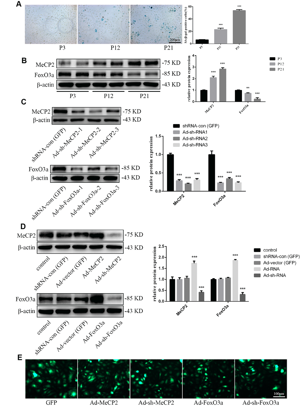 Protein expression during replicative aging and the efficacy of adenoviral vectors containing interference sequences. (A) Senescence-associated beta-galactosidase (SA-β-gal) staining during P3, P12, and P21 confirmed the increasing rate of aging EPCs during replicative senescence. (B) Protein levels of MeCP2 and FoxO3a were detected by western blotting during replicative senescence. (C) Protein levels of MeCP2 and FoxO3a were detected by western blotting after transfection with Ad-sh-MeCP2 or Ad-sh-FoxO3a. (D) Protein levels of MeCP2 and FoxO3a were detected by western blotting after overexpression and silencing of MeCP2 or FoxO3a. (E) Efficacy of adenoviral vectors was confirmed under fluorescence microscopy. *P 