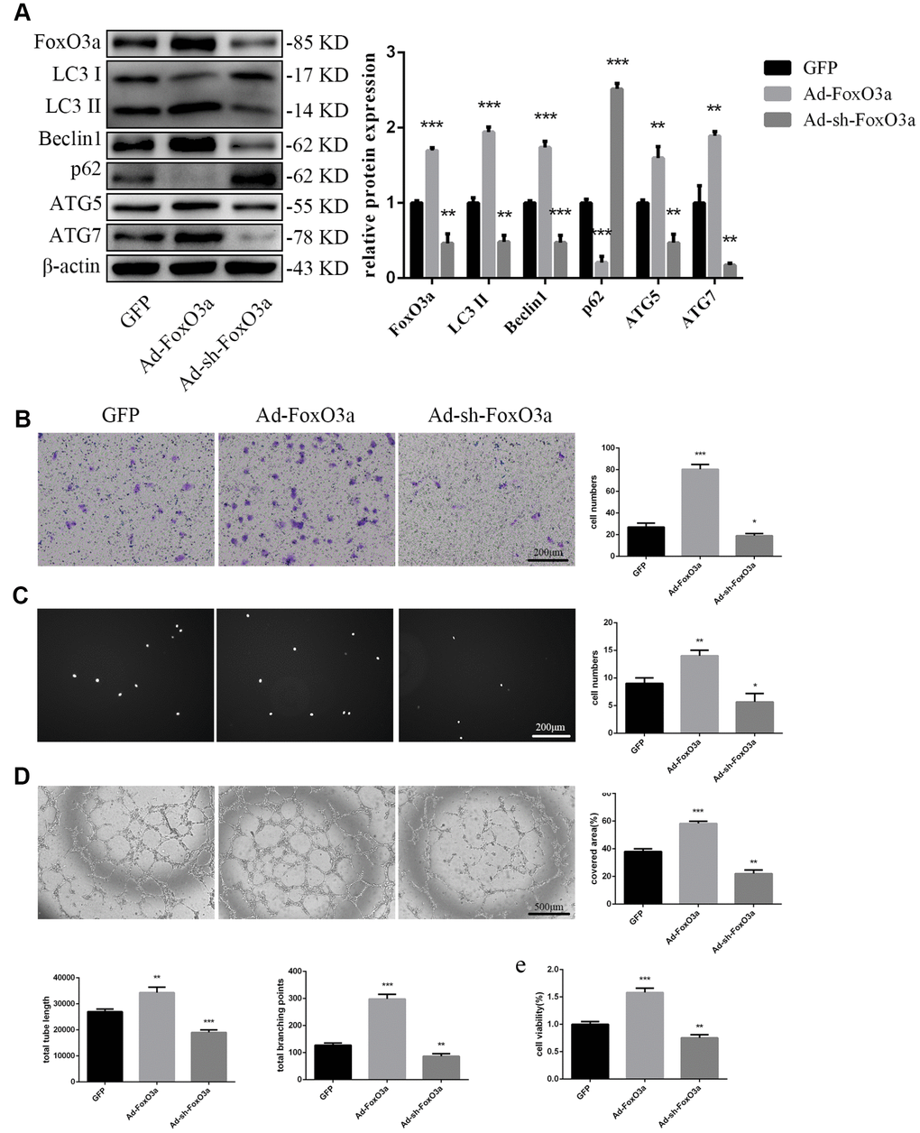 FoxO3a promoted autophagy and cellular function. (A) LC3 II, Beclin1, p62, ATG5, and ATG7 protein levels were detected by western blotting after transfection with Ad-FoxO3a or Ad-sh-FoxO3a for 48 h. (B) Cell migration was evaluated by Transwell migration assays after transfection with Ad-FoxO3a or Ad-sh-FoxO3a for 48 h. (C) Cell adhesion ability was evaluated by matrix adhesion assays after transfection with Ad-FoxO3a or Ad-sh-FoxO3a for 48 h. (D) Angiogenic ability was evaluated by Matrigel assays after transfection with Ad-FoxO3a or Ad-sh-FoxO3a for 48 h. (E) Cell viability was evaluated with CCK-8 after transfection with Ad-FoxO3a or Ad-sh-FoxO3a for 48 h. *P 