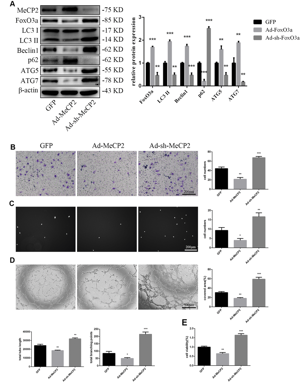 MeCP2 inhibited FoxO3a, autophagy, and cellular function. (A) Protein levels of FoxO3a, LC3 II, Beclin1, p62, ATG5, and ATG7 were detected by western blotting after transfection with Ad-MeCP2 or Ad-sh-MeCP2 for 48 h. (B) Cell migration was evaluated by Transwell migration assays after transfection with Ad-MeCP2 or Ad-sh-MeCP2 for 48 h. (C) Cell adhesion ability was evaluated by matrix adhesion assays after transfection with Ad-MeCP2 or Ad-sh-MeCP2 for 48 h. (D) Angiogenic ability was evaluated by Matrigel assays after transfection with Ad-MeCP2 or Ad-sh-MeCP2 for 48 h. (E) Cell viability was evaluated with CCK-8 after transfection with Ad-MeCP2 or Ad-sh-MeCP2 for 48 h. *P 