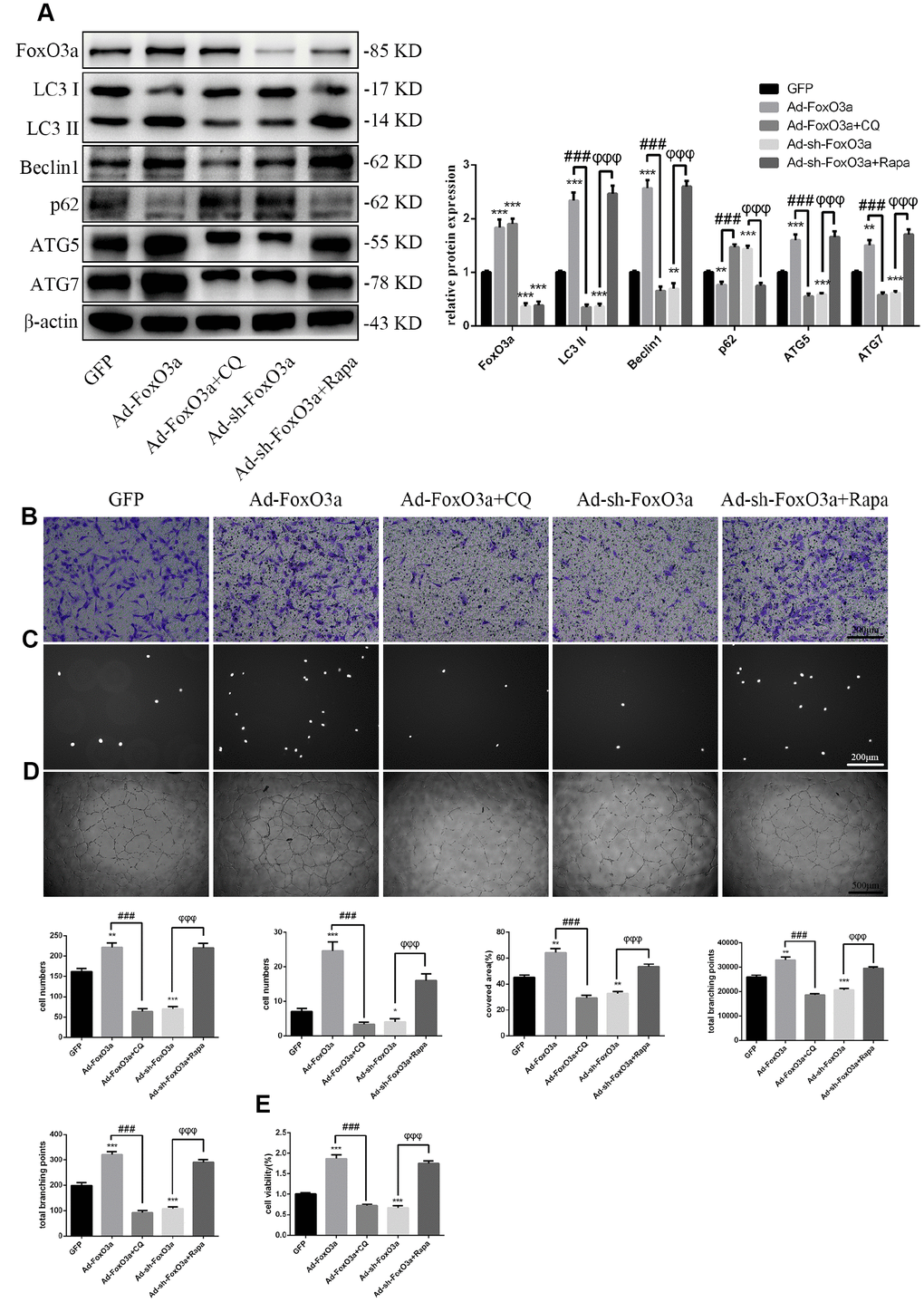FoxO3a promotes EPC functionality through autophagy. (A) LC3 II, Beclin1, p62, ATG5, and ATG7 protein levels were detected by western blotting after GFP, Ad-FoxO3a, Ad-FoxO3a + CQ, Ad-sh-FoxO3a, or Ad-sh-FoxO3a + Rapa. (B) Cell migration was evaluated by Transwell migration assays after treatment for 48 h. (C) Cell adhesion ability was evaluated by matrix adhesion assays after treatment for 48 h. (D) Angiogenic ability was evaluated by Matrigel assays after treatment for 48 h. (E) Cell viability was evaluated with CCK-8 after treatment for 48 h. *P #P ##P ###P φP φφP φφφP 