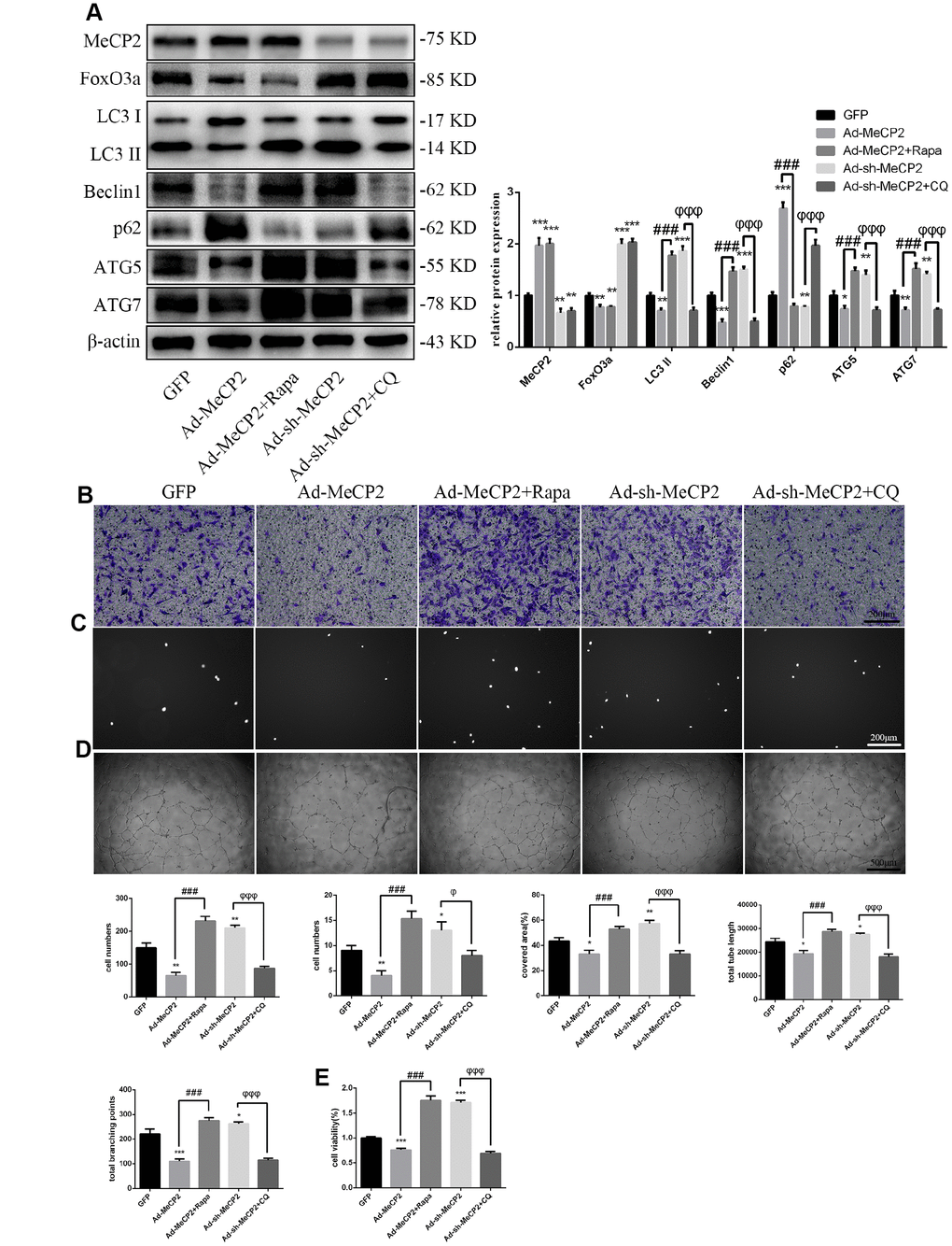 MeCP2 attenuates EPC functionality through autophagy. (A) FoxO3a, LC3 II, Beclin1, p62, ATG5, and ATG7 protein levels were detected by western blotting after GFP, Ad-MeCP2, Ad-MeCP2 + Rapa, Ad-sh-MeCP2, or Ad-sh-MeCP2 + CQ. (B) Cell migration was evaluated by Transwell migration assays after treatment for 48 h. (C) Cell adhesion ability was evaluated by matrix adhesion assays after treatment for 48 h. (D) Angiogenic ability was evaluated by Matrigel assays after treatment for 48 h. (E) Cell viability was evaluated with CCK-8 after treatment for 48 h. *P #P ##P ###P φP φφP φφφP 