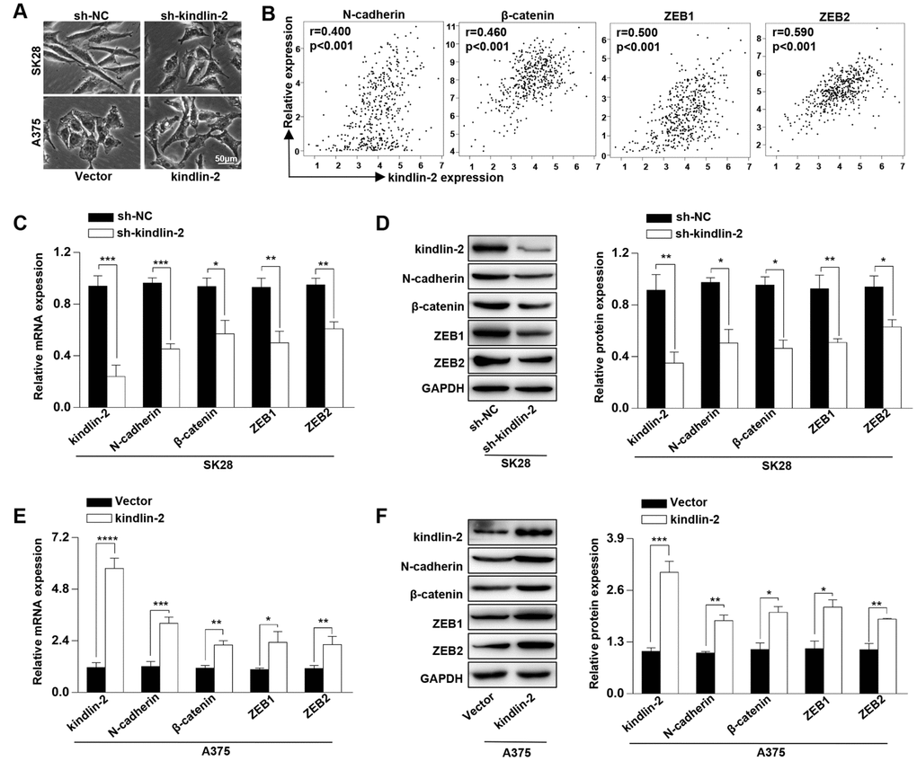 High levels of kindlin-2 induce the cellular EMT in melanoma. (A) The cell morphology of SK28-shNC, SK28-sh-kindlin-2, A375-Vector, and A375-kindlin-2 cells was observed by a phase-contrast microscopy. (B) Correlation analyses between the expression of kindlin-2 and N-cadherin, β-catenin, ZEB1, ZEB2 were performed with the TCGA database. (C and E) The mRNA levels of N-cadherin, β-catenin, ZEB1 and ZEB2 in SK28-shNC, SK28-sh-kindlin-2, A375-Vector and A375-kindlin-2 cells were analyzed by qRT-PCR. (D and F) The protein levels of N-cadherin, β-catenin, ZEB1 and ZEB2 in the indicated cells were analyzed by western blotting. *p**p***p