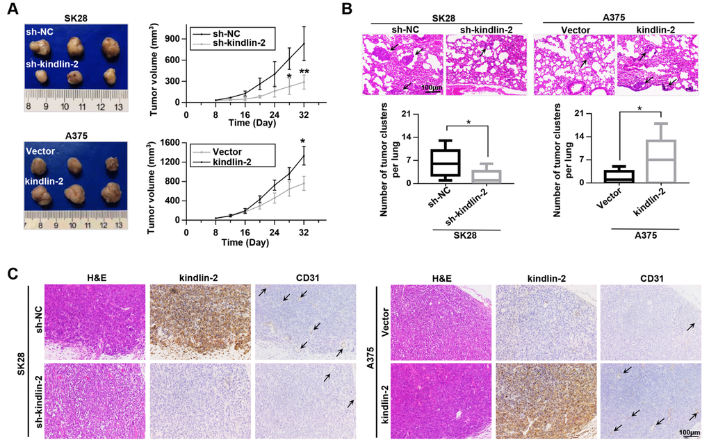 Kindlin-2 promotes tumour growth and lung metastasis in vivo. (A) SK28-shNC, SK28-sh-kindlin-2, A375-Vector and A375-kindlin-2 cells were subcutaneously inoculated to examine tumour growth ability (left); tumour growth curves of the subcutaneous xenografts were shown (right). (B) Lung metastasis was investigated with the metastasis model in vivo, and the number of metastases was examined by H&E staining. (C) Representative images from tumour serial sections stained with H&E and with kindlin-2 and CD31 antibodies by IHC. *p**p