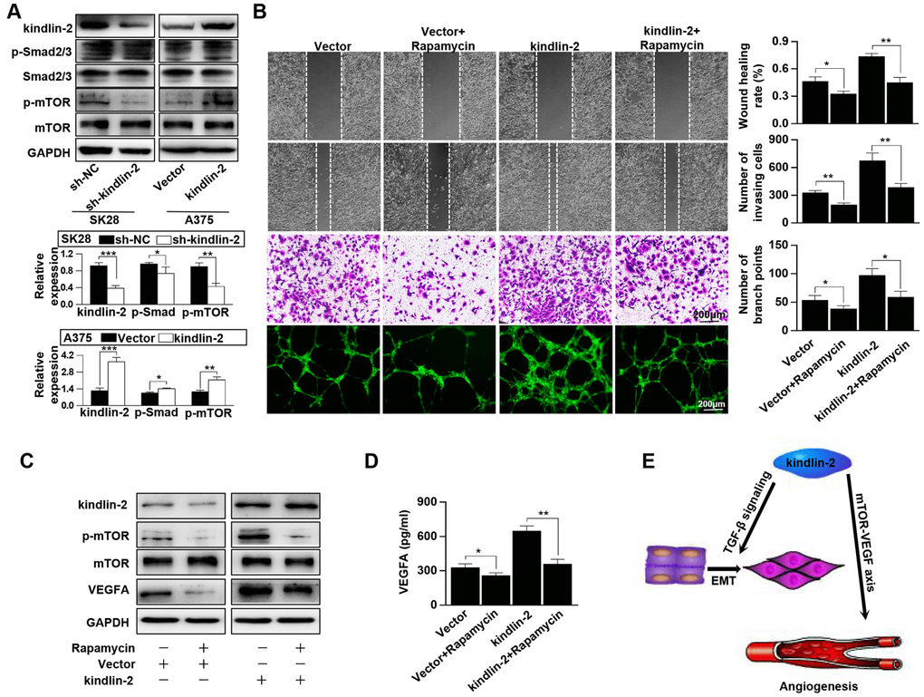 Kindlin-2 promotes angiogenesis and tumour progression via the mTOR pathway. (A) The protein levels of kindlin-2, p-Smad2/3, Smad2/3, p-mTOR and mTOR were detected in SK28-shNC, SK28-sh-kindlin-2, A375-Vector and A375-kindlin-2 cells by western blotting. (B) Migration, invasion and tube formation assays were performed in A375-Vector and A375-kindlin-2 cells after incubation with rapamycin. (C) Western blotting was used to detect the levels of kindlin-2, p-mTOR, mTOR and VEGFA in A375-Vector and A375-kindlin-2 cells after incubation with rapamycin. (D) ELISA was used to detect the secretion of VEGFA in the indicated cells. (E) A schematic model of kindlin-2-induced melanoma progression. *p**p