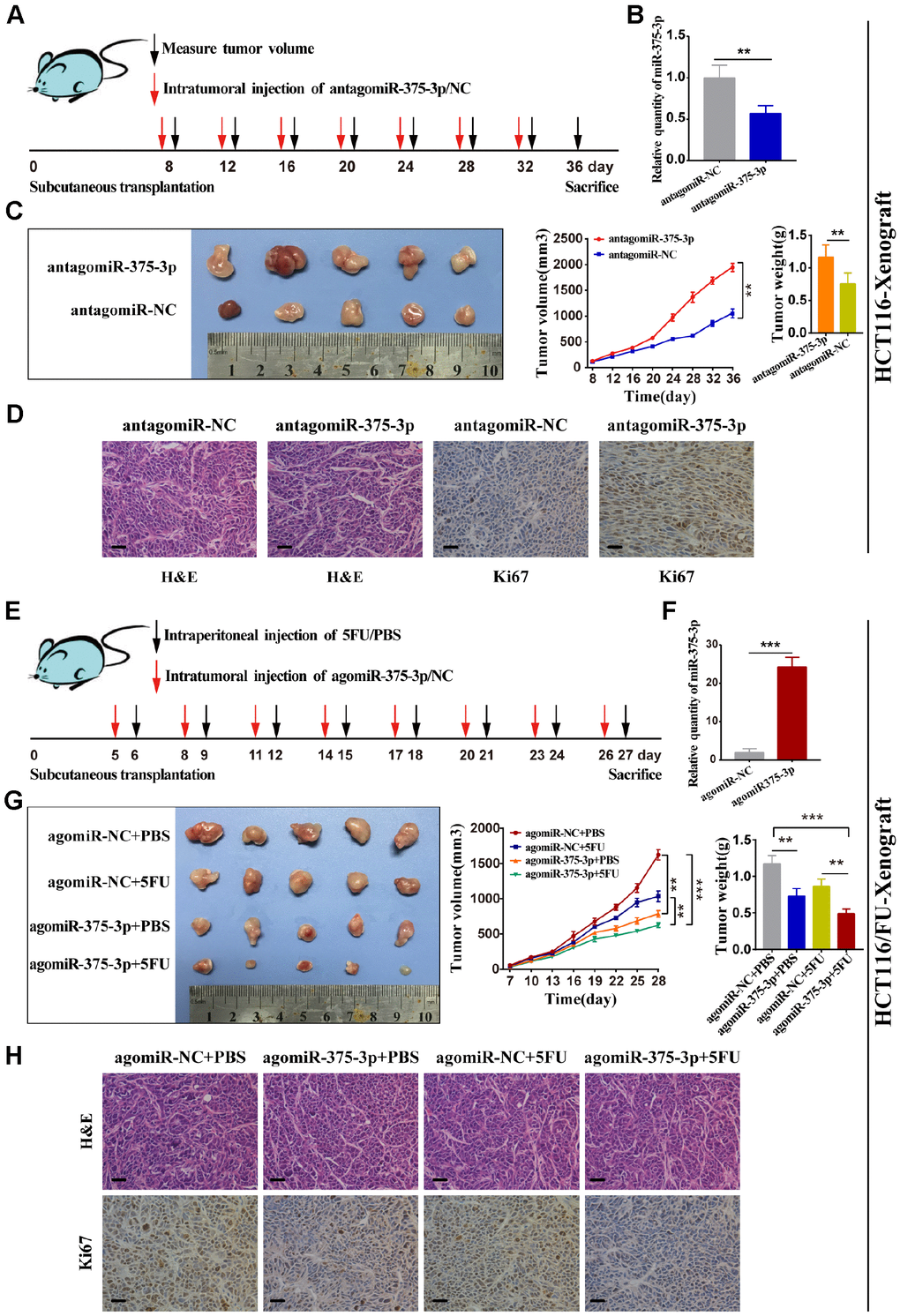 miR-375-3p suppresses tumorigenesis and reverses chemoresistance with 5FU of CRC in vivo. (A) Schematic outline of the treatment of HCT116 cells transfected with antagomiR-375-3p/NC in a subcutaneous tumor model followed by intratumoral injection of antagomiR-375-3p/NC. (B) qRT-PCR analysis of miR-375-3p expression in mice xenograft of antagomiR-375-3p/NC groups. (C) Representative images of transplanted tumors removed from mice after sacrifice at the 36th day, tumor volume and tumor weight were measured. (D) Representative images of hematoxylin and eosin (H&E) staining and Ki67 immunostaining of tumor lumps from two groups. Scale bar=50μm. (E) Schematic outline of the treatment of HCT116/FU cells transfected with agomiR-375-3p/NC in a subcutaneous tumor model followed by intratumoral injection of agomiR-375-3p/NC or PBS/5FU. (F) qRT-PCR analysis of miR-375-3p expression in mice xenograft of agomiR-375-3p/NC groups. (G) Representative images of transplanted tumors removed from mice after sacrifice at the 27th day, tumor volume and tumor weight were measured. (H) Representative images of hematoxylin and eosin (H&E) staining and Ki67 immunostaining of tumor lumps from 4 different groups. *P P P 