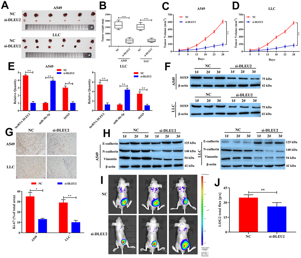 Knockdown of lncRNA DLEU2 suppresses tumor growth and epithelial to mesenchymal transition in vivo. (A) The tumor size was obtained from nude mice; (B) The tumor weight was measured in transferred si-DLEU2 or NC group; (C–D) The tumor volume curve of nude mice treated with si-DLEU2 or si-NC was analyzed; (E) The expression of lncRNA DLEU2, miR-30c-5p and SOX9 were measured by qRT-PCR; (F) The expression of SOX9 was measured by western blotting; (G) The expression of Ki-67 was detected in tumor tissues by immunohistochemistry; (H) Western blot was applied to detect E-cadherin, N-cadherin, and Vimentin protein expression in tumor tissues; (I) A549-si-DLEU2 and A549-NC were labeled with firefly luciferase and injected into the abdominal cavity of nude mice (n=3). (J) Histogram showing the bioluminescent signal intensity detected using a noninvasive In Vivo Imaging System. *p**p***p