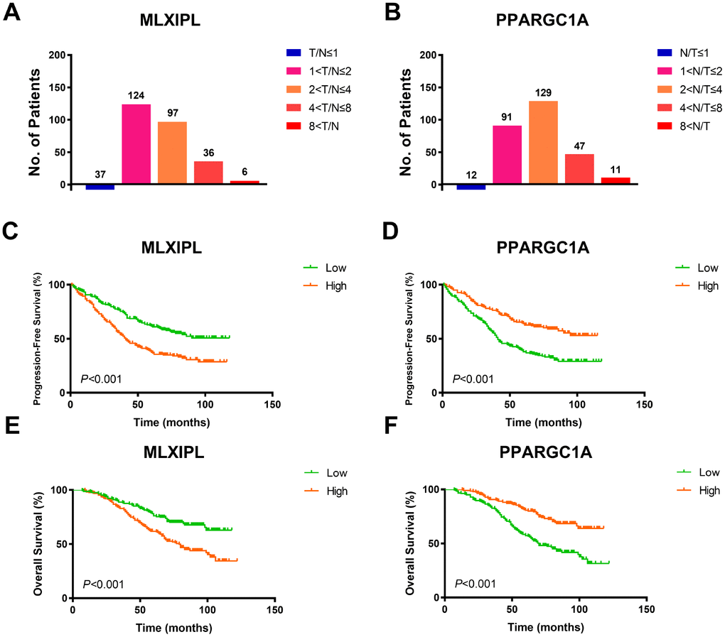 Prognostic validation of MLXIPL and PPARGC1A in FUSCC cohort. (A–B) To validate AQP9 mRNA expression profile in ccRCC tissues, we performed RT-qPCR using 380 paired tumor and normal samples with available clinical follow-up data from a real-world cohort. It revealed dramatically increased MLXIPL and decreased PPARGC1A mRNA expression in ccRCC samples than normal tissues. (C–F) Survival curves suggested that patients with elevated MLXIPL and decreased PPARGC1A mRNA levels significantly correlated with poorer PFS and OS (p