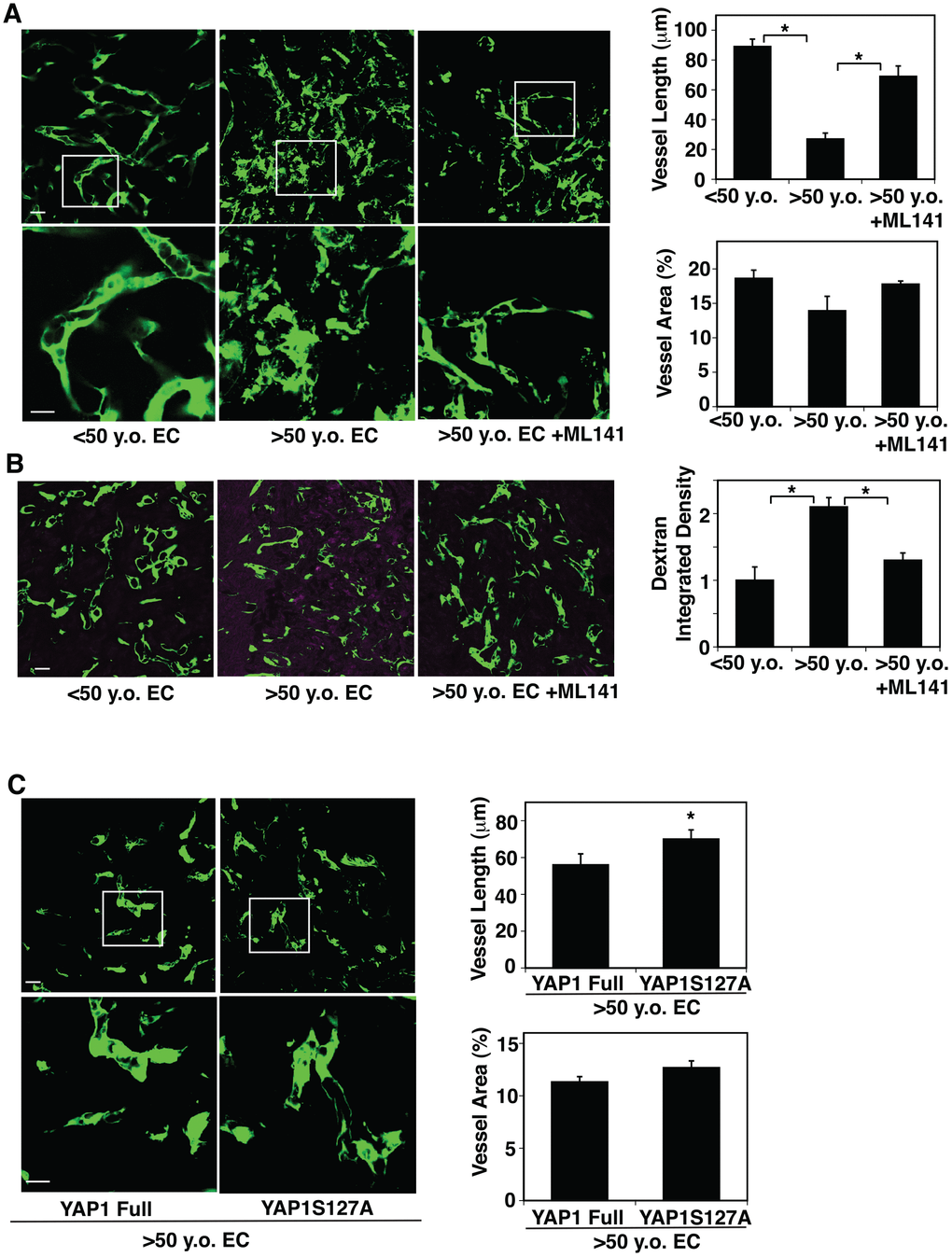 CDC42-YAP1 signaling mediates age-dependent decline in blood vessel formation in subcutaneously implanted gel. (A) IF micrographs showing vascular structures formed in the subcutaneously implanted fibrin gel supplemented with GFP-labeled ECs isolated from 50 y.o. human adipose tissues or in combination with treatment with ML141 (500 nM). Scale bar, 10 μm. Graphs showing quantification of vessel length (top) and vessel area (bottom) in the gel (n=7, mean ± s.e.m., *, pB) IF micrographs showing low MW fluorescently labeled dextran leakage (magenta) and GFP-labeled blood vessel formation (green) in the subcutaneously implanted fibrin gel supplemented with GFP-labeled ECs isolated from 50 y.o. human adipose tissues or in combination with treatment with ML141 (500 nM). Scale bar, 10 μm. Graph showing quantification of fluorescently labeled dextran leakage in the gel (n=7, mean ± s.e.m., *, pC) IF micrographs showing vascular structures formed in the subcutaneously implanted fibrin gel supplemented with GFP-labeled ECs isolated from >50 y.o. human adipose tissues in combination with treatment with retrovirus overexpressing full-length YAP1 or YAP1S127A mutant construct. Scale bar, 10 μm. Graphs showing quantification of vessel length (top) and vessel area (bottom) in the gel (n=7, mean ± s.e.m., *, p