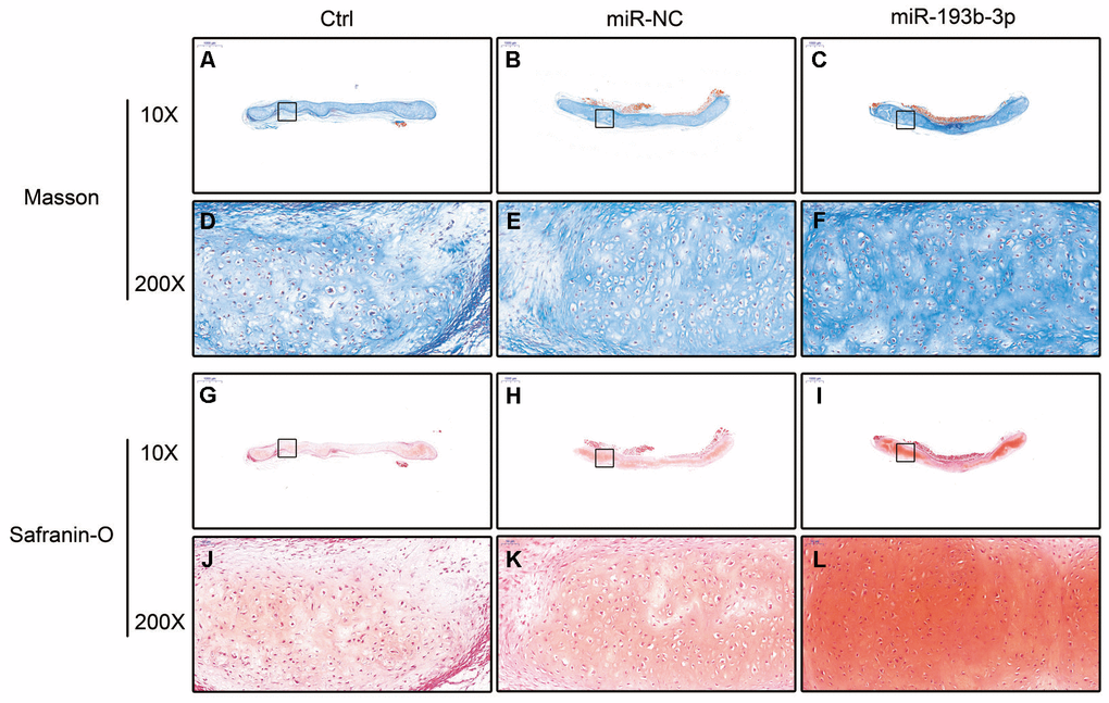 In vivo regenerative cartilage masson and safranin-O staining in different groups (n=3). (A–C) Masson staining magnification 10 times (bar 1000 μm). (D–F) Zoom square magnification x200; bar 50 μm. (G–I) Safranin-O staining magnification 10 times (bar 1000 μm). (J–L) Zoom square magnification x200; bar 50 μm.