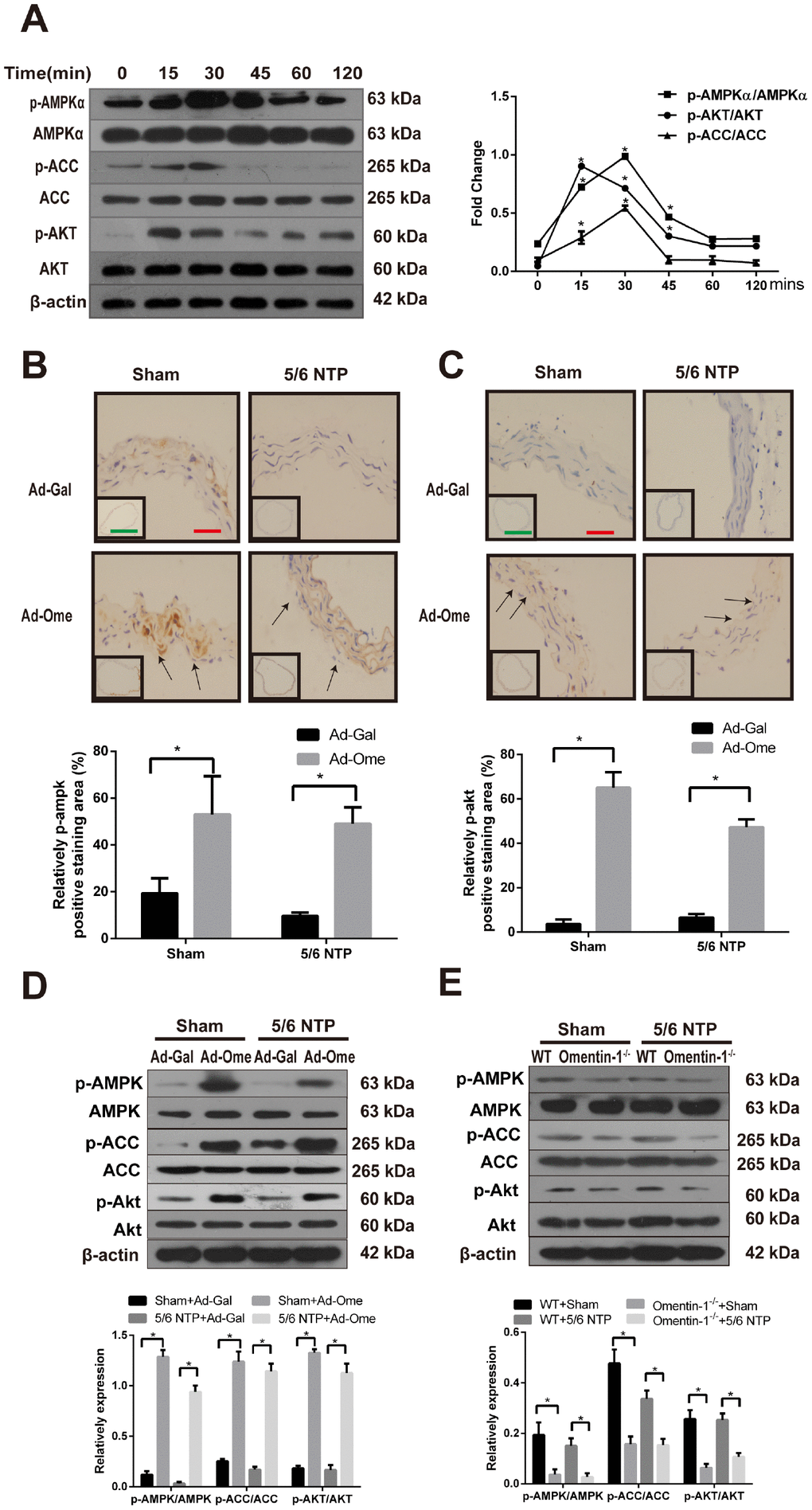 Effects of omentin-1 on activation of AMPK and Akt phosphorylation in CVSMCs and the 5/6 NTP-induced mouse calcification model. (A) CVSMCs were incubated with 400 ng/ml omentin-1 for either 0, 15, 30, 45, 60, or 120 min. Cells lysates were tested by western blot and incubated with antibodies against p-AMPKα, AMPKα, p-Akt, Akt, p-ACC and ACC. Representative results were shown in the left panel and densitometric quantification analysis for phosphorylation of Akt, AMPK and ACC was presented in the right panel. *p B) Representative immunostaining of phosphorylation of AMPK proteins (upper panel) and quantity of positive staining area in the thoracic aorta were shown in the lower panel (lower panel). (C) Representative immunostaining of phosphorylation of Akt proteins (upper panel) and quantity of positive staining area in the thoracic aorta were shown in the lower panel (lower panel). (D) Expression of p-AMPK, p-ACC and p-Akt in the mouse aorta treated with Ad-Ome or Ad-Gal were analyzed by western blot. (E) Expression of p-AMPK, p-ACC and p-Akt in the aorta of omentin-1 knockout mice or wild type mice were analyzed by western blot. Scale bar 20 μm (Red) and 500 μm (Green). *p 