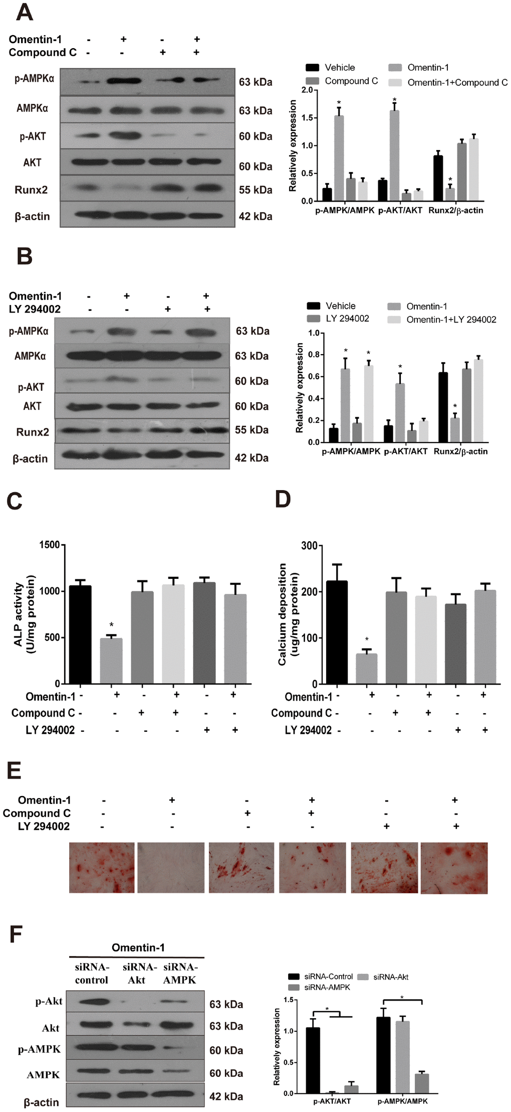 The AMPK/Akt signaling pathway mediates omentin-1-induced inhibition effects on osteoblastic differentiation and mineralisation of CVSMCs. CVSMCs were stimulated by Compound C (10 μM) or LY 294002 (30 μM) for 30 min and then treated with omentin-1 (400 ng/ml) for 48 hours. The cell lysates were tested by western blot and incubated with antibodies against p-AMPKα, AMPKα, p-Akt, Akt and Runx2. (A, B) Representative results were shown in the left panel and the data were presented as densitometric ratios of p-AMPK/AMPK, p-Akt/Akt and Runx2/β–actin respectively (lower panel). (C) The ALP activity was measured by ALP kit. Results are represented by mean ± SD with 3 replicates for each group. (*p D, E) CVSMCs were treated with Compound C (10 μM) or LY 294002 (30 μM) for 30 min and then treated with omentin-1 (400 ng/ml) every two days for a period of 14 days. Calcium deposition was tested (D) and represented microscopic pictures of Alizarin Red S staining view were shown (E). (F) Expression of p-AMPK and p-Akt in CVSMCs after AMPK or Akt knockdown were analyzed by western blot. All Results are represented by mean ± SD with 3 replicates for each group. One-way ANOVA with the Tukey’s HSD post hoc analysis was adopted.