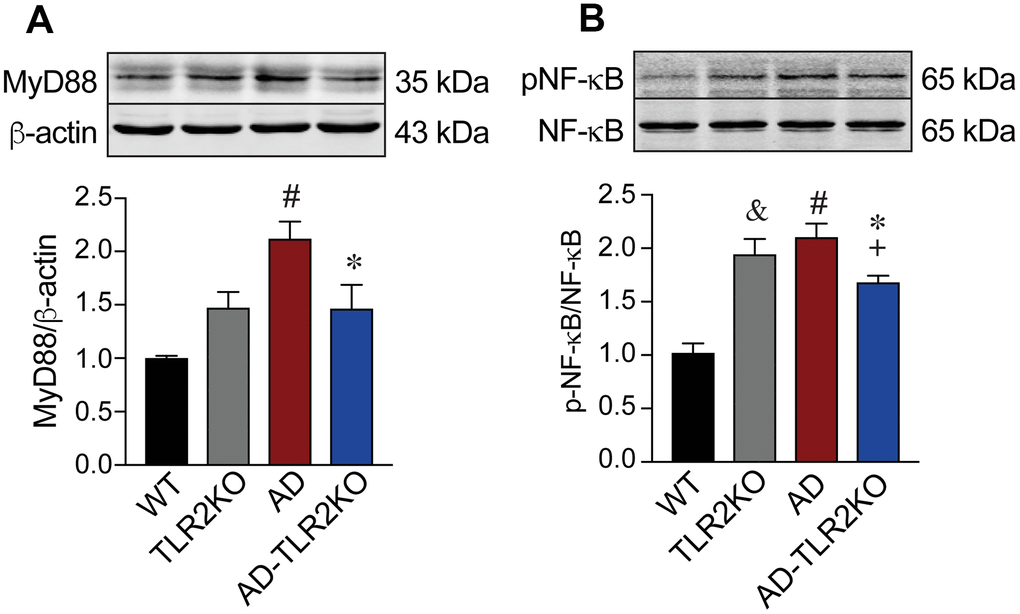 Activation of MyD88-NFκB signaling. Expression of MyD88 significantly increased in AD mice compared with WT mice (p
