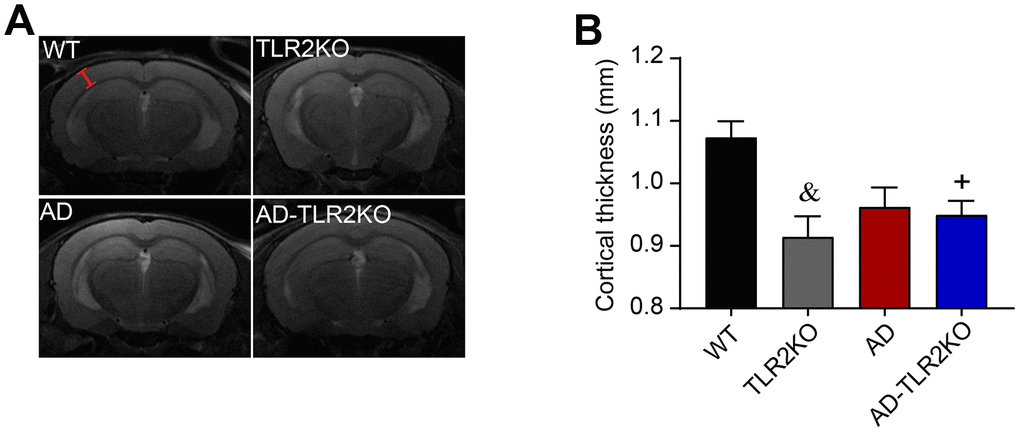 Thickness of cortex evaluated by T2-weighted images detected by 7 Tesla MRI system. The cortical thickness was measured by Image J software on T2-weighted images obtained from Paravision software. (A) Representative T2-weighted images used for measurement of cortical thickness (red line segment indicates the measured regions). (B) Results showed that cortical thickness was reduced in TLR2KO mice and AD-TLR2KO mice compared with WT mice (&: TLR2KO vs. WT, p