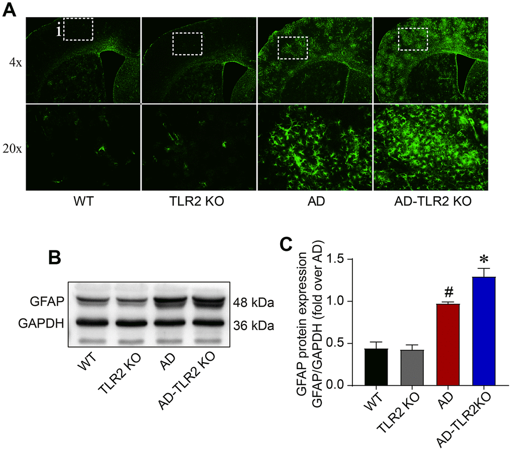 Levels of GFAP in mouse brains. (A) Representative immunofluorescence staining of GFAP, a marker of astrocytes. (B) Representative bands of GFAP in brain tissues detected by Western blots. (C) GFAP significantly increased in AD mice and AD-TLR2KO mice compared with WT and TLR2 mice, respectively (#: AD vs. WT, p