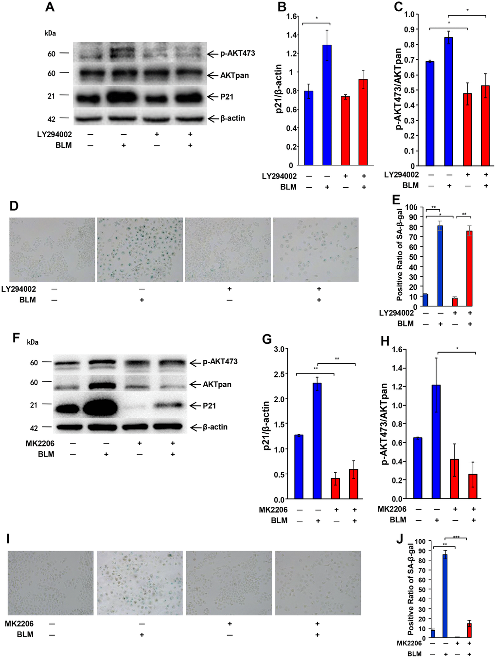 Inhibition of Akt activation attenuates AEC senescence. Inhibitor (20 μm/L LY294002 or 5 μg/ml MK2206) of the AKT pathway was added 1 hour before bleomycin (10 μg/ml). After 72 hours, the medium was changed to fresh medium for 24 hours. AKT inactivation and P21WAF1 expression induced by LY294002 (A–C) or MK2206 (F–H) were detected by western blotting. Cellular senescence after inhibitor LY294002 (D, E) or MK2206 (I, J) pretreatment was analyzed by SA-β-Gal staining. Data are shown as the mean ± SEM, n ≥ 3 per group. *p 