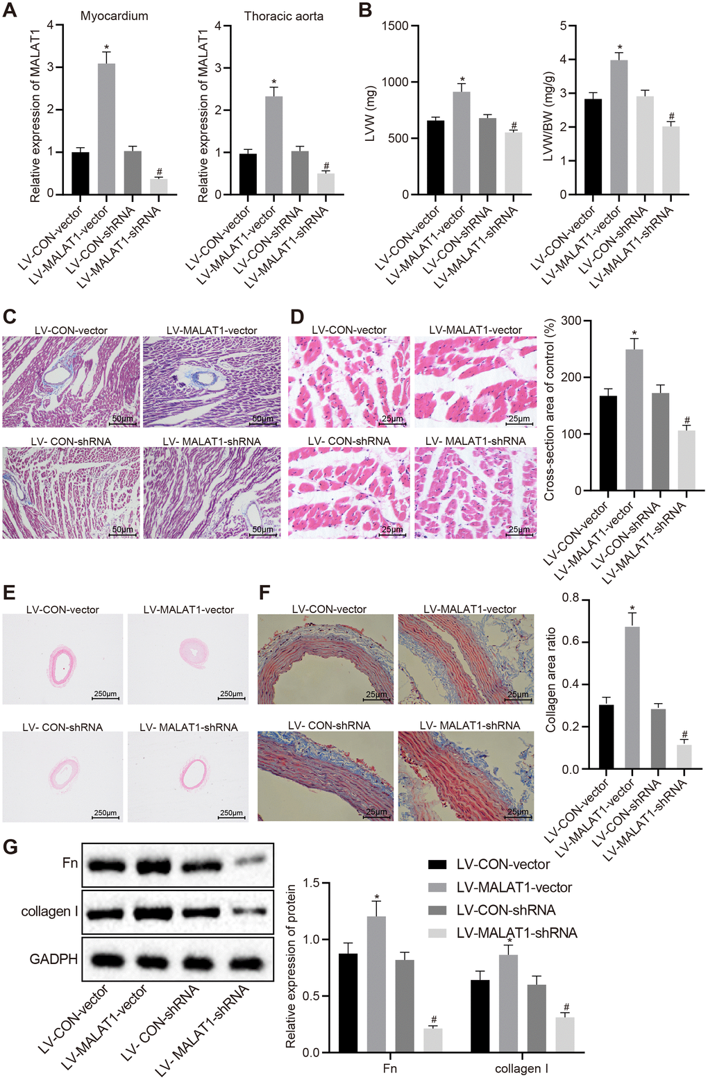 LncRNA MALAT1 over-expression promotes cardiac remodeling in hypertensive rats. (A) the expression of lncRNA MALAT1 in myocardial tissues and thoracic aortic vascular tissues of SHRs after over-expression or silencing of lncRNA MALAT1 detected by RT-qPCR; B, LVW and LVW/BW ratio in SHRs after over-expression or silencing of lncRNA MALAT1; (C) Masson staining images of myocardial tissues after over-expression or silencing of lncRNA MALAT1 (scale bar = 50 μm); (D) HE staining images of myocardial tissues after over-expression or silencing of lncRNA MALAT1 (scale bar = 25 μm); (E) pathological changes of thoracic aortic vascular tissues of SHRs observed using HE staining after over-expression or silencing of lncRNA MALAT1 (× 40); (F) collagen deposition in thoracic aortic vascular tissues of SHRs after over-expression or silencing of lncRNA MALAT1, observed by Masson staining (× 400); (G) the expression of fibronectin and collagen protein in thoracic aortic vascular tissues of SHRs after over-expression or silencing of lncRNA MALAT1, determined by Western blot analysis; *, p vs. the LV-CON-vector group; #, p vs. the LV-CON-shRNA group; measurement data were expressed by means ± standard deviation and analyzed by one-way analysis of variance; n = 6.