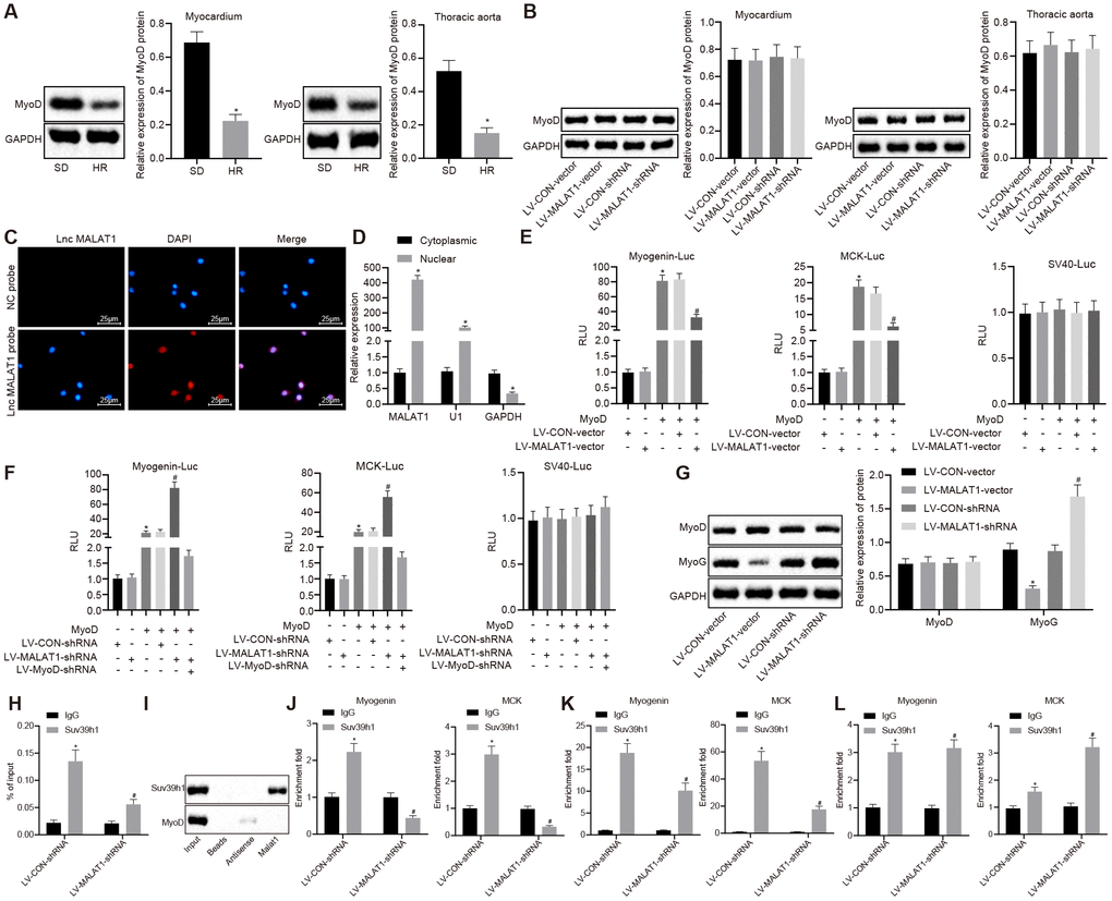 LncRNA MALAT1 over-expression suppresses the transcription of MyoD. (A) the expression of MyoD in myocardial tissues and thoracic aortic vascular tissues of SD rats and SHRs detected by Western blot analysis; (B) the expression of MyoD in myocardial tissues and thoracic aortic vascular tissues of SHRs after over-expression or silencing of lncRNA MALAT1; (C) cellular location of lncRNA MALAT1 determined using FISH (× 400); (D) enrichment of lncRNA MALAT1, U1, and GAPDH in nuclear or cytoplasmic fractions of ASMCs; (A) luciferase activity of Myogenin-Luc and MCK-Luc in VMSCs in response to over-expression or silencing of lncRNA MALAT1; (G) the expression of MyoD and MyoG in VSMCs of SHRs after over-expression or silencing of lncRNA MALAT1, as measured by Western blot analysis; (H) RIP assay of nuclear extracts from the VSMCs immunoprecipitated by IgG or an antibody against Suv39h1 and RT-qPCR measurement of the retrieved RNAs; (I) RNA pull-down assay of in vitro-transcribed biotinylated full-length lncRNA MALAT1 transcripts and the binding proteins as well as Western blot analysis of the indicated proteins; (J–L) ChIP-PCR analysis of Suv39h1, H3K9me3 and MyoD enrichment on the promoter or enhancer of Myogenin, MCK loci in VSMCs. The enrichment fold was calculated as a fraction of DNA present in the input samples. *, p vs. the SD rats or cytoplasmic RNA or LV-CON-vector group or LV-CON-shRNA group or IgG group; #, p vs. the MyoD or Suv39h1 or H3K9me3; measurement data were expressed by means ± standard deviation and analyzed by unpaired t-test; n = 3.