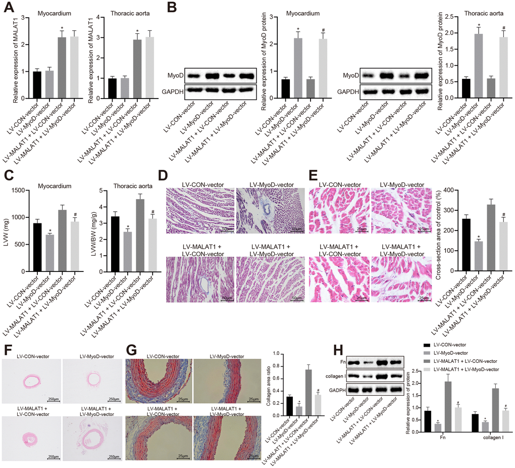 The promoting effects of over-expressed lncRNA MALAT1 on cardiac remodeling in hypertensive rats is reversed by over-expression of MyoD. (A) the expression of lncRNA MALAT1 in myocardial tissues and thoracic aortic vascular tissues of SHRs, as measured by RT-qPCR; (B) the expression of MyoD in myocardial tissues and thoracic aortic vascular tissues of SHRs measured using Western blot analysis; (C) LVW and LVW/BW ratio of SHRs; (D) Masson staining images of myocardial tissues (scale bar = 50 μm); (E) HE staining images of myocardial tissues (scale bar = 25 μm); (F) pathological changes of thoracic aortic vascular tissues of SHRs, observed by HE staining (× 40); (F) collagen deposition in thoracic aortic vascular tissues of SHRs, observed by Masson staining (× 400); (H) the expression of fibronectin and collagen I in thoracic aortic vascular tissues of SHRs, measured by Western blot analysis; *, p vs. the LV-CON-vector group; #, p vs. the LV-MALAT1 + LV-CON-vector group; measurement data were expressed by means ± standard deviation and analyzed by one-way analysis of variance; n = 6.