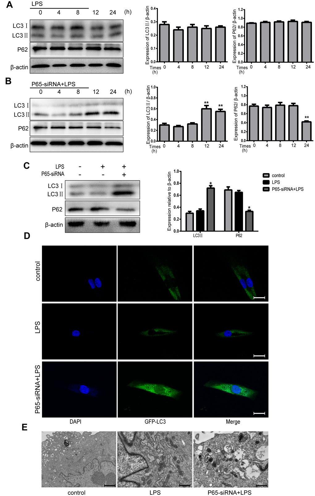 Inhibiting NF-κB promotes autophagy in LPS-induced NPCs. (A) After treatment with LPS for 4-24 h, the protein expression levels of LC3 II and P62 were measured by western blot. (B) After treatment with LPS plus p65-siRNA for 4-24 h, the protein expression levels of LC3 II and P62 were measured by western blot. (C) Western blot analysis for the protein expression levels of LC3 II and P62 after various treatment for 24 h. (D) NPCs were transfected with adenovirus containing GFP-LC3 and the formation and distribution of GFP-LC3 punctate were observed under confocal microscopy (Amplification×800). (E) Morphological observation of autophagy under transmission electron microscope (magnification ×30,000). Values are means ±SEM.*p#p