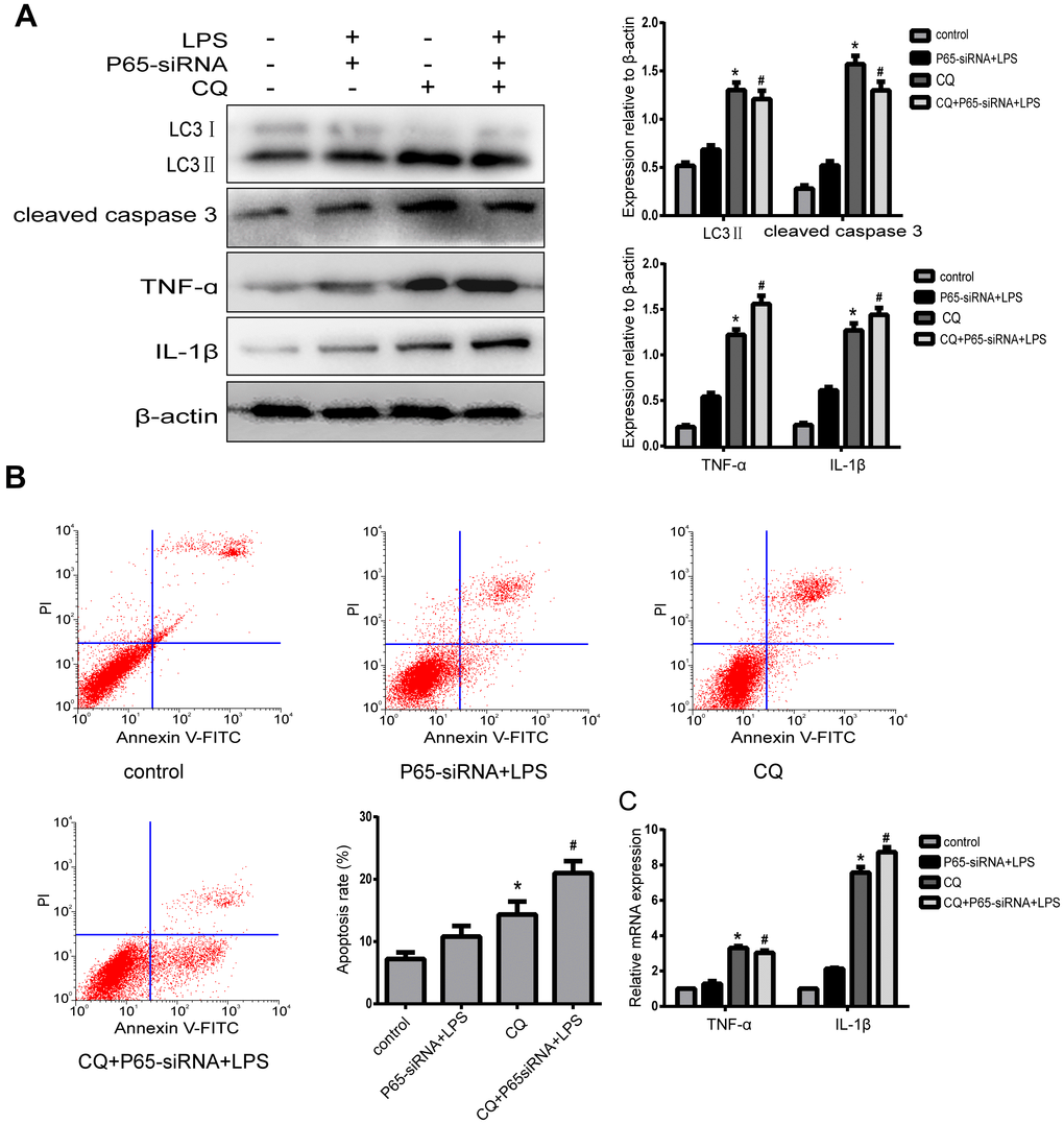 Inhibiting NF-κB blocks apoptosis and inflammatory of degenerative human NP cells by promoting autophagy. (A)After NPCs were pre-treated by autophagy inhibitor CQ, western blot analysis for the expression of LC3 II, cleaved caspase3, TNF-α and IL-1β. (B) The apoptosis rate was detected by flow cytometry. (C) Real-time analysis for the expression of TNF-α and IL-1β. Values are means ±SEM.*p#p