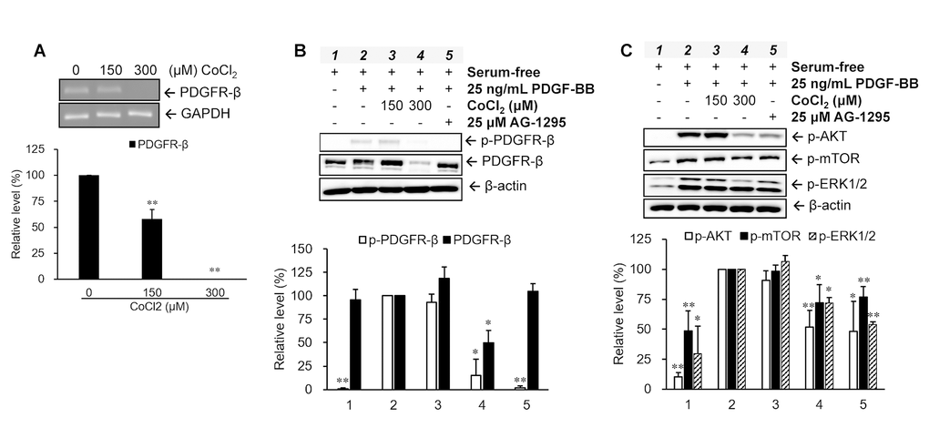 Changes in platelet-derived growth factor (PDGF) receptor (PDGFR)-β-mediated pathways in senescent vascular smooth muscle cells (VSMCs). Cells were treated with different concentrations of CoCl2 for 72 hr. Expression and activation levels of PDGFR-β were analyzed using an RT-PCR (A) and Western blotting (B), respectively. The phosphorylation levels of the downstream signaling molecules of PDGFR-β were examined after 15 min of stimulation with 25 ng/ml PDGF-BB under serum-free condition (C). * p p 