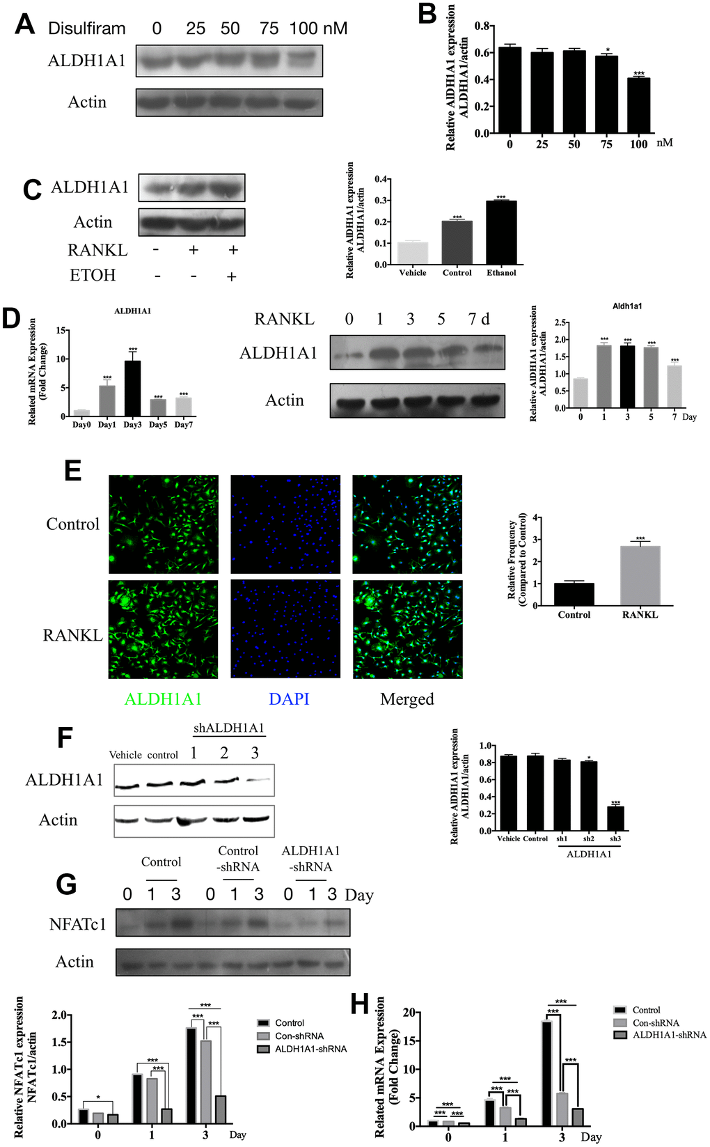 Disulfiram inhibits ethanol-induced osteoclastogenesis via ALDH1A1. (A) Disulfiram inhibited the expression ALDH1A1 in a dose-dependent manner. (B) Relative expression of ALDH1A1 was determined by densitometric analysis of each band and expressed as a ratio to that of β-actin using ImageJ software. (C) Ethanol increased the expression of ALDH1A1. Total cellular proteins were extracted from BMM-derived OCs treated with 100 ng/mL RANKL, with or without ethanol, for 3 days. Relative expression of ALDH1A1 was determined by densitometric analysis of each band and expressed as a ratio to that of β-actin using ImageJ software. (D) qPCR was used to measure the relative levels of ALDH1A1 expression, normalized to those of β-actin, at different times of osteoclastogenesis (n = 3). Values are the mean ± SD. *p p p E) Representative immunofluorescence images of ALDH1A1 from BMMs treated with or without RANKL, showing that RANKL increased ALDH1A1 in the cytoplasm and the nucleus. Nuclei were counterstained with DAPI (blue). (F) Efficiency of ALDH1A1 silencing was determined by immunoblot analysis. Relative expression of ALDH1A1 was determined by densitometric analysis of each band and expressed as a ratio to that of β-actin using ImageJ software. (G) Silencing of ALDH1A1 decreased the expression of NFATc1. Total cellular proteins were extracted from RAW 264.7 cells and RAW 264.7 cells transfected with Lenti-ALDH1A1 or Lenti-NC, after co-treatment with RANKL for 0, 1, and 3 days. (H) qPCR was used to measure the relative expression levels of ALDH1A1, normalized to those of β-actin (n = 3). Values are the mean ± SD. *p p p 