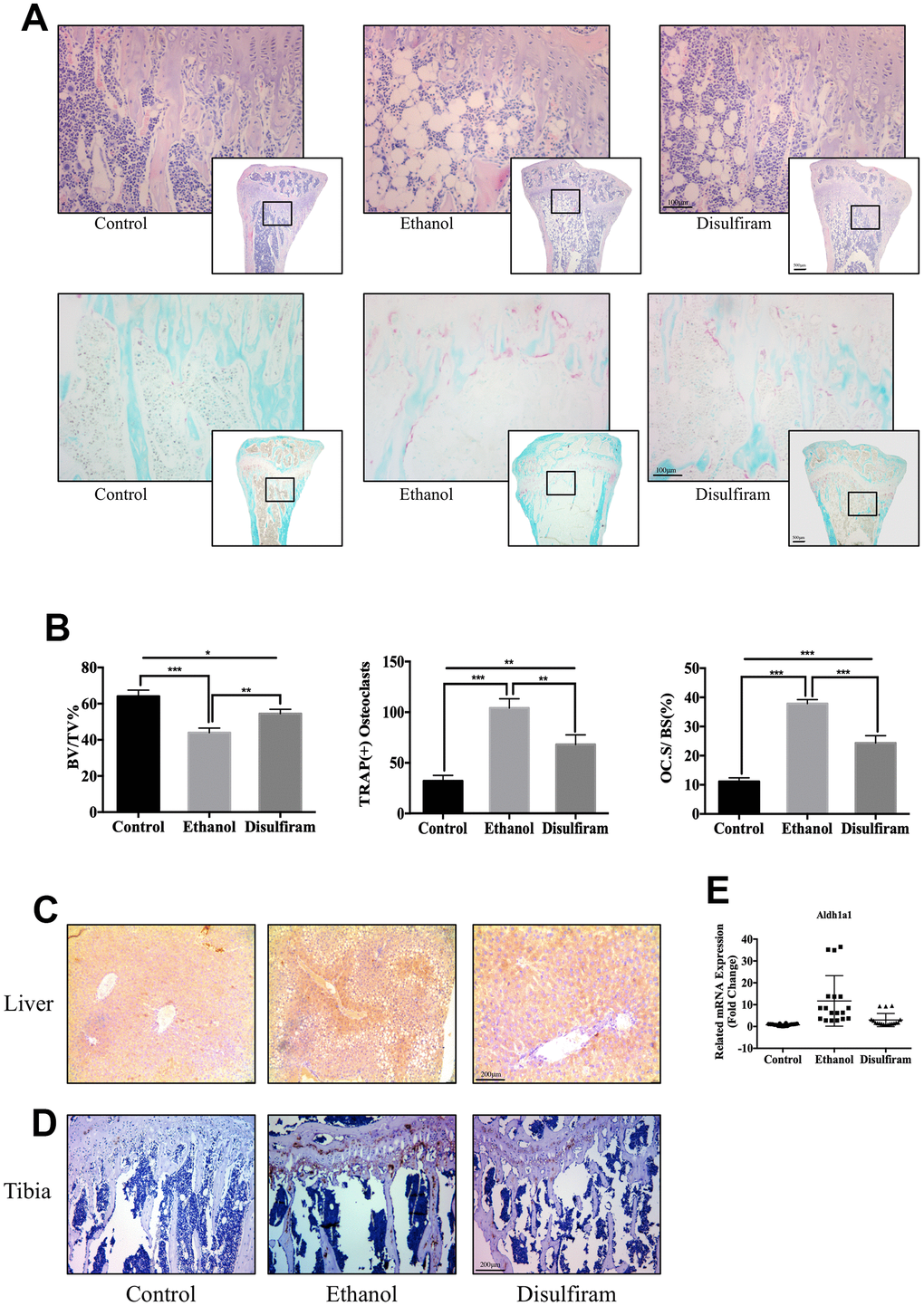 Disulfiram protected against Alcohol-Induced bone loss via ALDH1A1. (A) Sections of tibias were stained with H&E and TRAP. (B) Data of quantitative analyses of histomorphometric bone parameters of the bone volume to tissue volume (BV/TV), number of TRAP-positive OCs, and percentage of the OC surface to bone surface (Oc.S/BS, %) (n = 6). (C) Immunohistochemical staining of ALDH1A1 expression in the liver. (D) Immunohistochemical staining of ALDH1A1 expression in the tibia. (E) qPCR was conducted to measure the relative levels of gene expression, normalized to those of β-actin, in each group of mice (n = 6). Bar graphs are presented as the mean ± SD. *p p p 