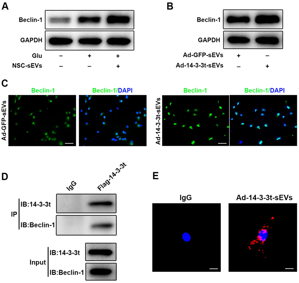 14-3-3t enhanced autophagy by interacting with Beclin-1. (A) Western blot assay for Beclin-1 in neuronal cells. (B) Western blot analysis of Beclin-1 in the Ad-GFP-sEVs and Ad-14-3-3t-sEVs groups in neuronal cells. (C) The expression of Beclin-1 proteins in neurons of the Ad-GFP-sEVs and Ad-14-3-3t-sEVs groups was detected by immunofluorescence. Scale bar = 50um. (D) Following the overexpression of flag-14-3-3t (from adenovirus) in neuronal cells, anti-Flag antibody was added. Co-immunoprecipitation results showed that 14-3-3t interacts with Beclin-1 in neuronal cells. (E) Indirect in situ PLAs were used to visualize protein interactions using red fluorophore-labeled oligonucleotides. Those assays showed that endogenous Beclin-1 interacted and co-localized with 14-3-3t in neurons following Glu treatment. Scale bar = 20um. Glu, Glutamate; PLA, Proximity ligation assay.