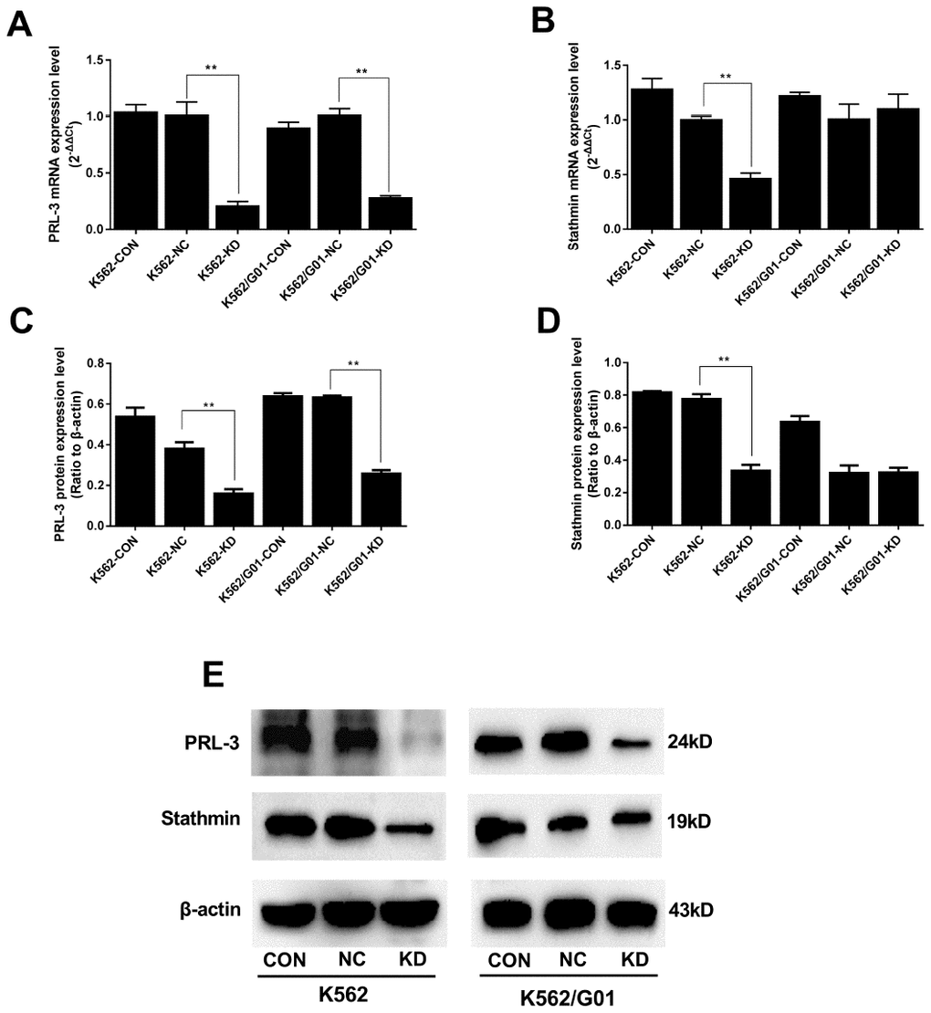 Expression of PRL-3 and stathmin was assessed after PRL-3-silencing in K562 and K562/G01 cells. (A) The mRNA expression of PRL-3 after transfection. (B) The mRNA expression of stathmin after PRL-3-silencing. (C, D) Quantification of PRL-3 and stathmin were normalized to β-actin. (E) Western blot of PRL-3 and stathmin expression were detected after shPRL-3. (*PPvs. NC group).