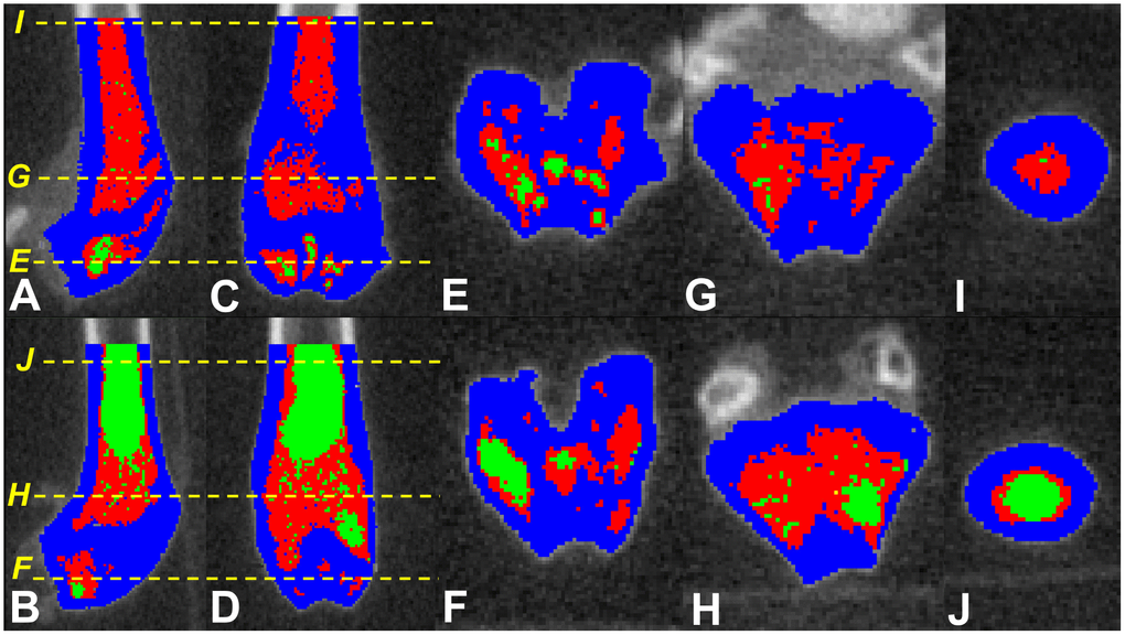 Screen shots of the tagged images of the distal femora of SAMP8 mice fed fish oil supplemented (upper panel) and control (lower panel) diets. Parasagittal (A and B) and coronal/frontal (C and D) plane sections: (E–J) (yellow) dotted lines represent the cross-sectional planes that images (E–J) display. Those fed fish oil-enriched diet appear to have higher bone (blue), hematopoietic marrow (red) and lower marrow adipose tissue (green) compared to controls.