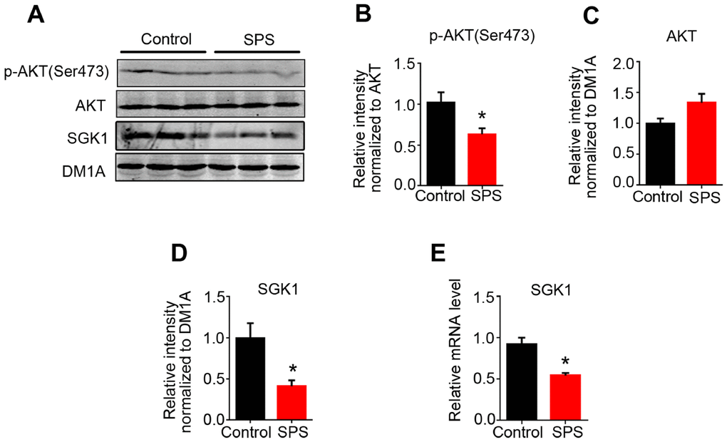 SPS downregulates the activity of AKT and SGK1 expression level. (A) WB results showed the level of AKT, p-AKT at Ser 473, SGK1. (B and C) The level of p-AKT was decreased, but total AKT protein level didn’t change. Protein (D) and mRNA (E) levels of SGK1 were markedly decreased in SPS rats compared to control. All data represent mean ± SEM, n=3, *P 