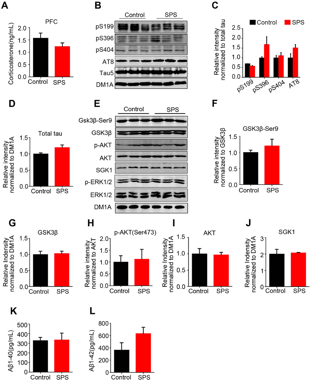 No change of tau and/or tau-related kinases in the prefrontal cortex of SPS rats. (A) The level of corticosterone wasn’t significant different compared with control in prefrontal cortex. (B–D) WB protein bands showed an increase tendency of tau, but no statistical significance. (E–J) tau-related kinase detected by WB showed no changes between the two groups. (K and L) SPS-induced PTSD didn’t alter Aβ1-40 and Aβ1-42 production in the prefrontal cortex. All data represent mean ± SEM, n=3.