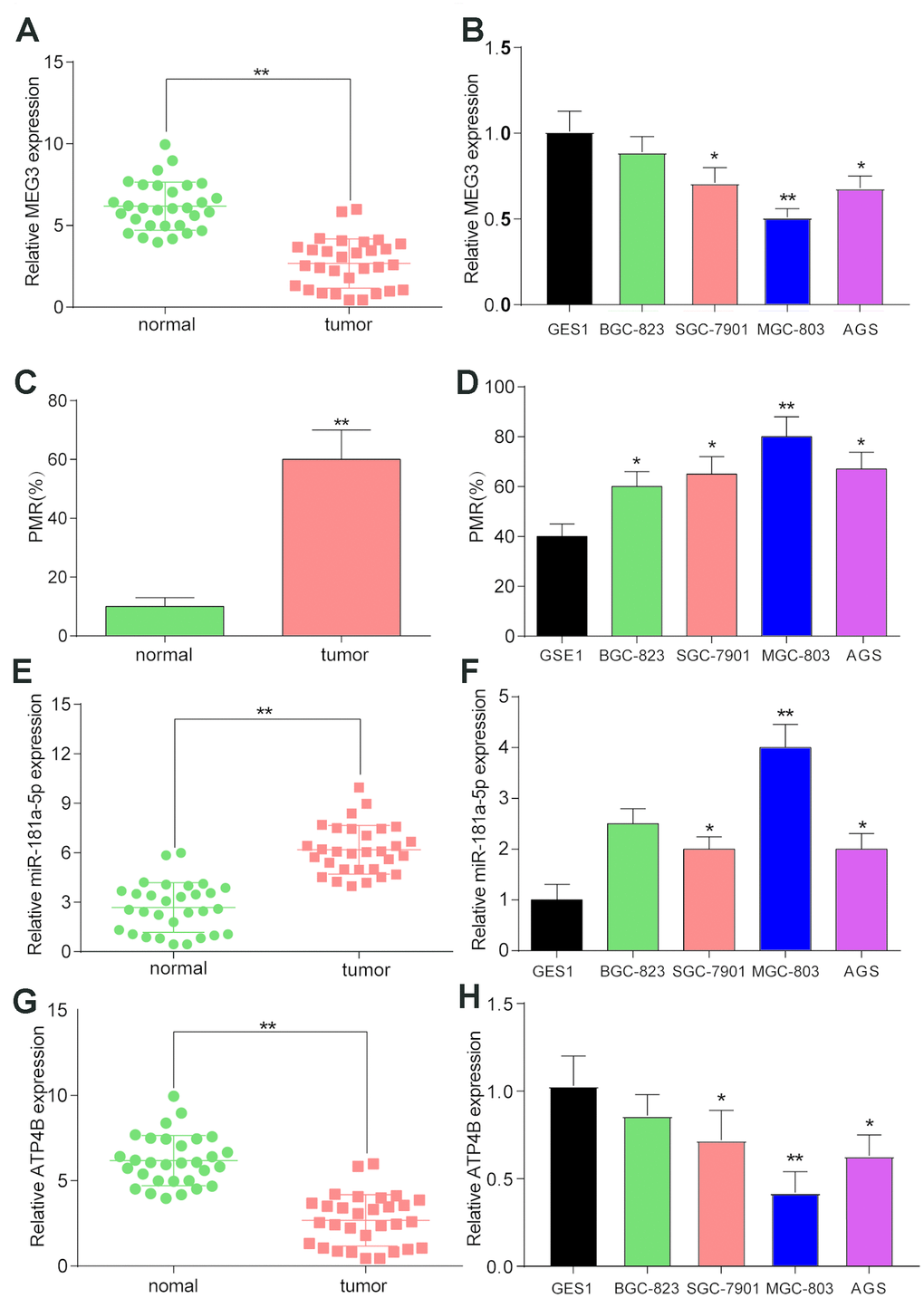 The expression and methylation status of target factors in gastric cancer and gastric cancer cell lines. (A) LncRNA MEG3 was found to be expressed at low levels in thirty GC samples compared to normal tissues. **PB) LncRNA MEG3 was also found to be downregulated in BGC-823, SGC-7910, MGC-803 and AGS GC cell lines compared to the GES 1 normal cell line. *PPC) MSP results showed that lncRNA MEG3 was hypermethylated in tumor tissues compared with normal tissues. **PD) Hypermethylation of lncRNA MEG3 was also detected in BGC-823, SGC-7910, MGC-803 and AGS GC cell lines compared to the GES 1 normal cell line. *PPE) MiR-181a-5p was upregulated in tumor tissues compared with their corresponding normal tissues. **PF) QRT-PCR results showed higher expression of miR-181a-5p in BGC-823, SGC-7910, MGC-803 and AGS GC cell lines compared to the GES 1 normal cell line. *PPG) QRT-PCR results showed lower expression of ATP4B in tumor tissues compared to normal tissues. **PH) QRT-PCR results showed higher expression of ATP4B in BGC-823, SGC-7910, MGC-803 and AGS GC cell lines compared to the GES 1 normal cell line. *PP