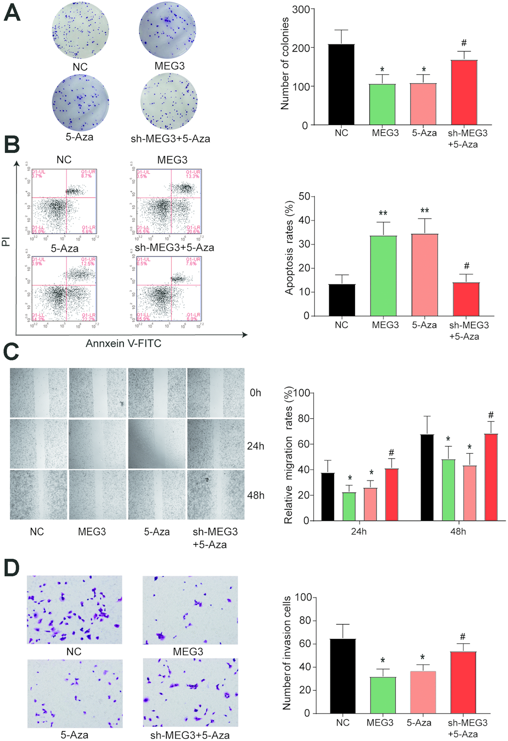 Restored expression of MEG3 inhibits the development of gastric cancer cells. (A) The number of clones was significantly reduced in the lncRNA MEG3-overexpressing group and the 5-Aza group compared with the NC group. *PPPB) The apoptosis rate of MGC-803 cells transfected with MEG3 or 5-Aza dramatically increased compared with the NC group. *PPPC–D) Wound healing and transwell assays showed significantly reduced cell migration and invasion ability in the MEG3 and 5-Aza groups compared to the control group. *PPP