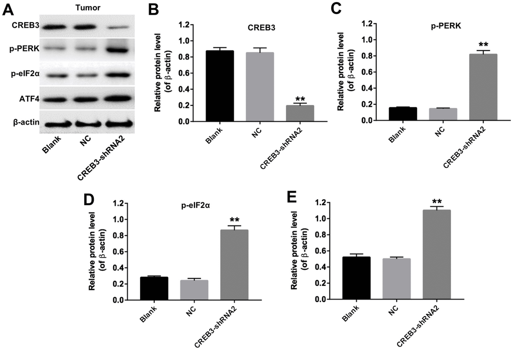 The downregulation of CREB3 activated ERS pathway proteins in tumor tissues. (A) The levels of CREB3, p-PERK, p-eIF2α and ATF4 in tumor tissues were detected by Western blotting. (B–E) The relative levels of CREB3 (B), p-PERK (C), p-eIF2α (D) and ATF4 (E) were quantified and normalized to β-actin levels. **P