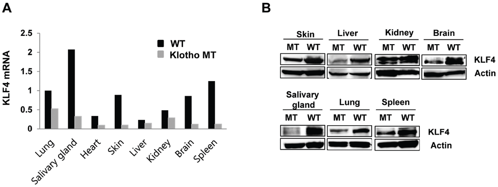 Kruppel-like factor (KLF) 4 is downregulated in various tissues harvested from klotho (-/-) mice. (A) Expression of mRNA encoding KLF4 in wild type and klotho (-/-) mouse tissues (as measured by qRT-PCR). (B) Protein expression of KLF4 in tissues harvested from wild-type and klotho (-/-) mice. Total protein samples were collected from the skin, liver, kidney, brain, salivary gland, lung, and spleen. The expression of KLF4 protein was determined by Western blot. Actin was used as an internal control.