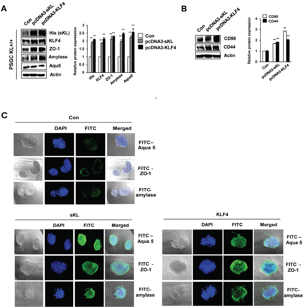 Functional restoration of PSGCs by soluble klotho and KLF4 expression. (A) Detection of the CD90 and CD44 protein levels in soluble klotho- or KLF4-expressing PSGCs. Cells were transfected with soluble klotho or KLF4 expression plasmids. At 48 h after transfection, total protein was prepared and subjected to immunoblotting. (B) Expression of KLF4, aquaporin 5, ZO-1, and amylase in PSGCs after transfection with soluble klotho or KLF4 expression plasmids. (C) Immunofluorescence staining of aquaporin 5, ZO-1, and amylase in PSGCs cultured on 3D Matrigel at day 5.