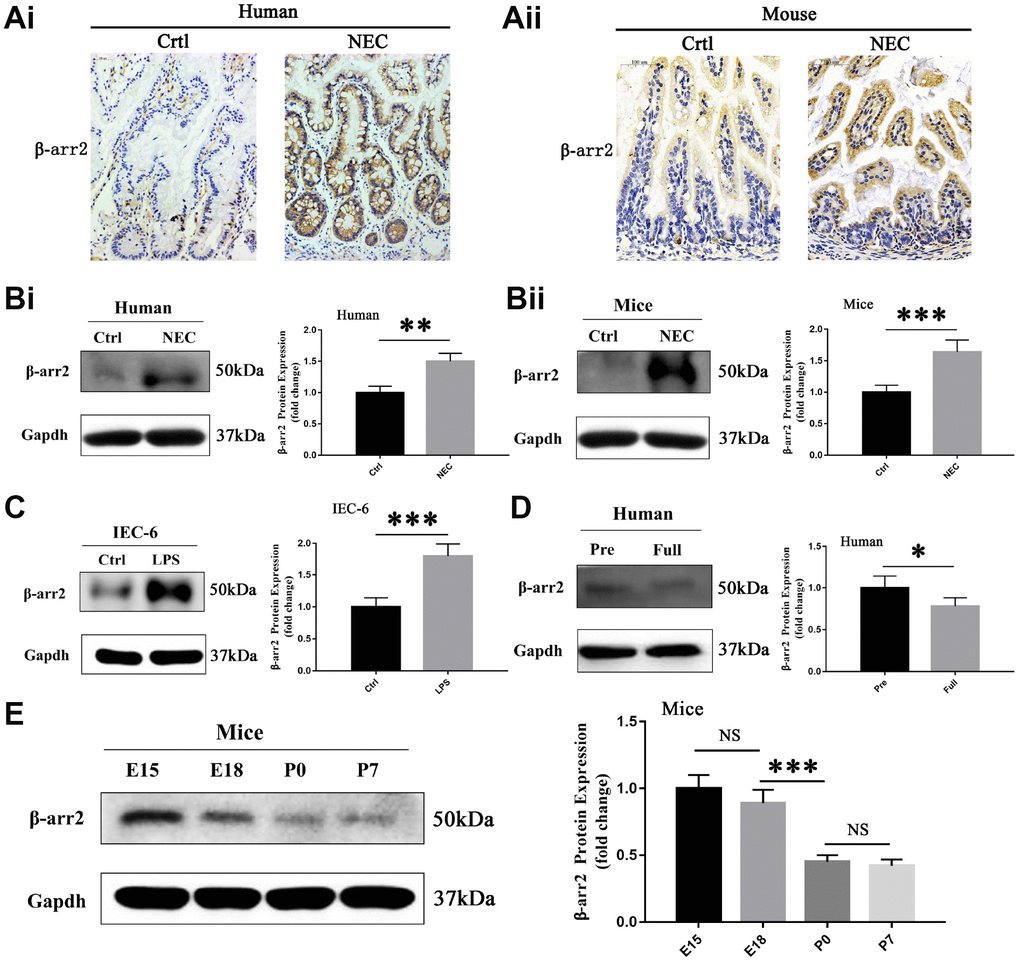 β-arrestin-2 is upregulated in NEC in humans, mice and IECs. (A) Immunohistochemical staining demonstrated that β-arrestin-2 expression was greater in both humans and mice with NEC than in healthy controls. (B) β-arrestin-2 protein was detected in the neonatal intestine, and was upregulated in NEC samples from both humans (n=6) and mice (n=6). (C) LPS stimulation increased β-arrestin-2 expression in IEC-6 cells. (D) β-arrestin-2 expression was greater in premature than in full-term human infants (n=6). (E) In mice, β-arrestin-2 levels in the distal ileum trended down from embryonic day 15 (E15) to postnatal day 7 (P7) (n=6).