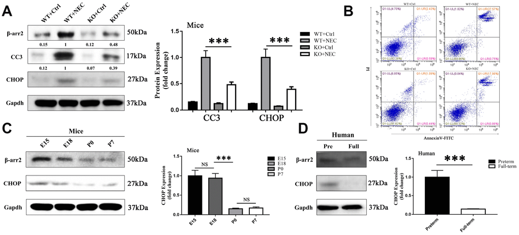 β-arrestin-2 promotes the development of NEC by inducing ER stress. (A) Cleaved caspase 3 (CC3) expression in KO+NEC mice was less than half of that in WT+NEC mice (n=5). (B) Flow cytometry analysis revealed a greater proportion of apoptotic IECs in WT+NEC mice (27.57%) than in KO+NEC mice (17.98%) (n=5). (C) In mice, CHOP expression trended down from E15 to P7 (n=3). (D) In humans, CHOP expression was greater in premature than in full-term infants (n=5).