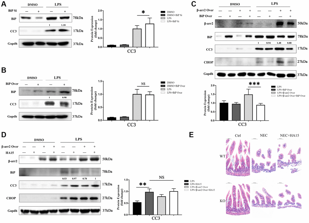 BiP suppresses β-arrestin-2-induced pro-apoptotic effects. (A) Silencing of BiP increased apoptotic marker expression in LPS-stimulated cells. (B) Overexpression of BiP did not significantly alter apoptotic marker expression in LPS-stimulated cells. (C) Co-transfection of β-arrestin-2 and BiP significantly inhibited apoptosis compared with β-arrestin-2 transfection alone in LPS-treated cells (PD) HA15 inhibited BiP protein expression and increased CC3 expression in LPS-treated cells, regardless of whether or not β-arrestin-2 was overexpressed. (E) KO+NEC and WT+NEC mice pretreated with HA15 displayed almost the same degree of intestinal damage.