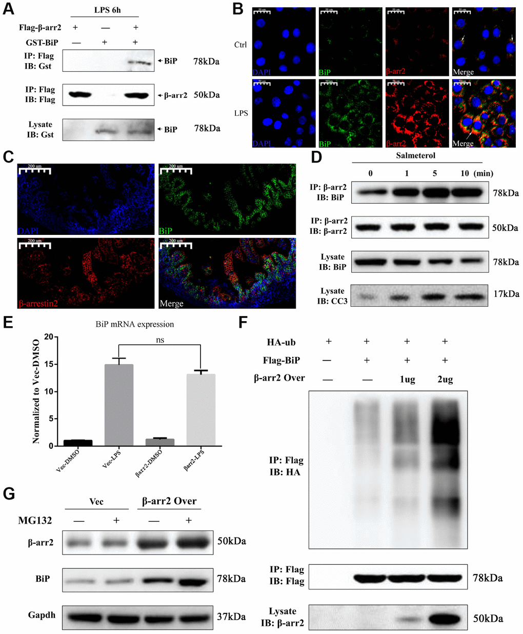 β-arrestin-2 binds to BiP and promotes its polyubiquitination and degradation. (A) A co-immunoprecipitation assay revealed that β-arrestin-2 bound directly to BiP in LPS-stimulated cells. (B) An immunofluorescence assay demonstrated the colocalization of β-arrestin-2 and BiP in IEC-6 cells. (C) An immunofluorescence assay identified cells that were double-positive for β-arrestin-2 and BiP in NEC mouse intestinal specimens. (D) Salmeterol time-dependently improved the binding between β-arrestin-2 and BiP, and also increased apoptotic marker expression. (E) BiP mRNA expression was not significantly influenced by β-arrestin-2 overexpression. (F) β-arrestin-2 increased the ubiquitination of BiP in a dose-dependent manner in LPS-stimulated cells. (G) The ubiquitin-proteasome inhibitor MG132 increased BiP protein levels when β-arrestin-2 was overexpressed.