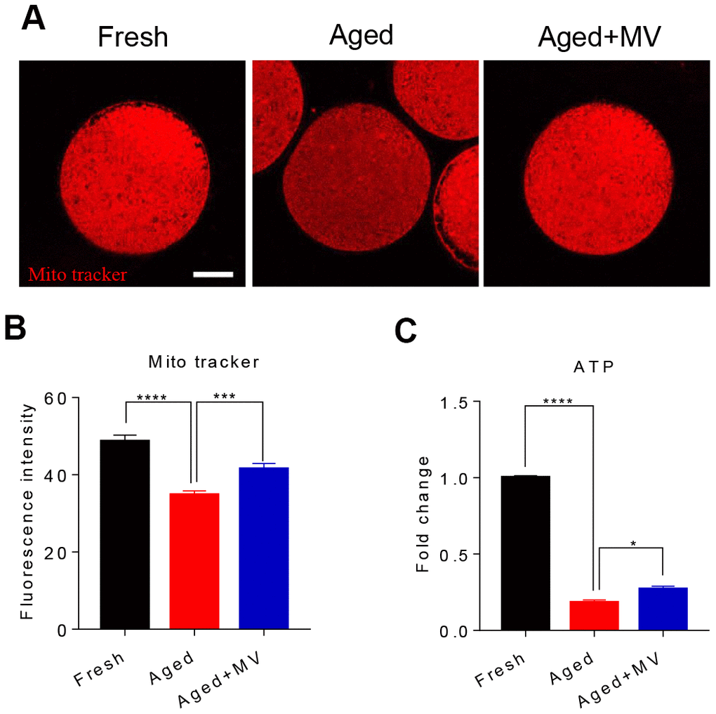 Effects of mogroside V on mitochondrial and ATP contents in oocytes during in vitro ageing. After in vitro maturation for 44 h, oocytes that extruded the first polar body were continuously cultured in vitro with or without MV for 24 h. (A) Representative images of fresh, aged and aged+MV oocytes stained with MitoTracker™ Orange CMTMRos. (B) Quantitative analysis of the mitochondrial content. (C) Quantitative analysis of the ATP content. The data are presented as the mean ± SEM of at least three independent experiments. MV, mogroside V; Scale bar = 50 μm. * P P P 