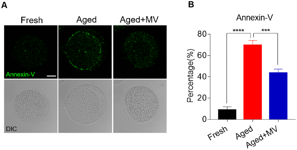 Effect of mogroside V on early apoptosis in oocytes during in vitro ageing. After in vitro maturation for 44 h, oocytes that extruded the first polar body were continuously cultured in vitro with or without MV for 24 h. (A) Representative images of fresh, aged and aged+MV oocytes stained with Annexin-V. (B) Quantitative analysis of Annexin-V fluorescence intensity. The data are presented as the mean ± SEM of at least three independent experiments. Mogroside V, MV; Scale bar = 50 μm. *** P P 