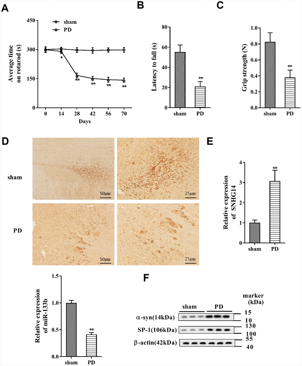 SNHG14 expression was increased in PD mouse model. PD mouse models (n=7) were constructed, with the sham group (n=7) served as control. The motor function of PD mice was assessed with (A) rotarod performance, (B) reversed screen test, and (C) forelimb grip strength test. (D) Immunohistochemistry staining was performed to determine the number of Tyrosine Hydroxylase (TH)-positive DA neuron in the brain tissues of mice. (E) Relative expression of SNHG14 and miR-133b in brain tissues of mice was quantified by qRT-PCR. (F) Protein level of α-syn and SP-1 in brain tissues of mice was analyzed with western blotting. *P