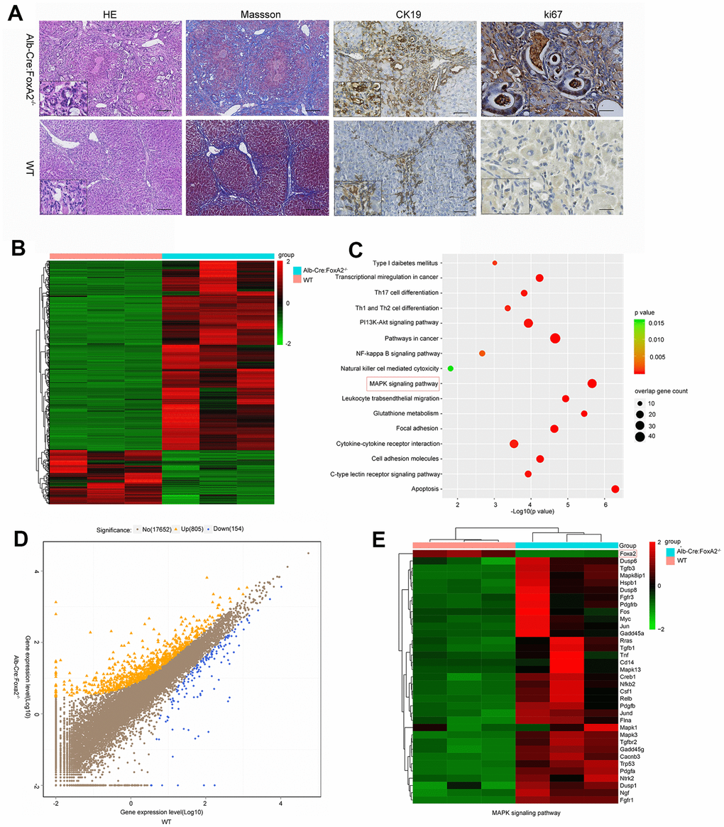 Loss of FoxA2 promotes the development of intrahepatic bile duct neoplasms and enhances MAPK-related gene expression. (A) Hematoxylin and eosin staining showed remarkable bile duct neoplasm formation in FoxA2-/- mice. Significant liver cirrhosis and proliferation (Ki67 immunohistochemistry) were also observed in the bile duct in FoxA2-/- mice (n=3 each group); (B) Heatmap showing the most differentially expressed genes (DEGs) between FoxA2-/- mice and WT mice. (n = 3 samples per group); (C) KEGG analysis of biological processes. Most of these DEGs were clustered in the “MAPK signaling pathway” category, followed by the “Pathways in cancer”, and “PI13K-AKT signaling pathway”, and so on. The bar indicates the P value; the threshold of P = 0.015 is shown; (D) Volcano plot of P values as a function of the weighted fold change for mRNAs; 805 genes were upregulated genes and 154 were down regulated in FoxA2-/- mice compared with WT mice.; (E) the activation of MAPK-signaling-related genes expression in FoxA2-/- mice.
