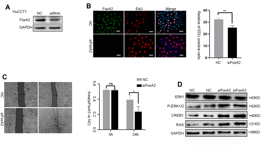 The suppression of FoxA2 promotes activation of the MAPK signaling pathway. (A) The effect of FOXA2 suppression in HuCCT1 cells by siFOXA2; (B) Cell proliferation was detected with EdU in ICC cells after suppression of FoxA2; (C) The invasion assay was used to assess the effects of FoxA2 down regulation on ICC cell invasion; (D) The expression of ERK1, P-ERK1/2, CREB1 and RAS in ICC cell lines was detected by Western blot after the suppression of FoxA2.